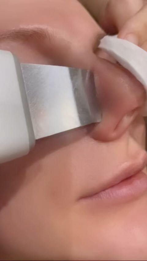 Those girls have ultra- sonic peeling at the start of their facial treatments 🙌🙋🏻♀️