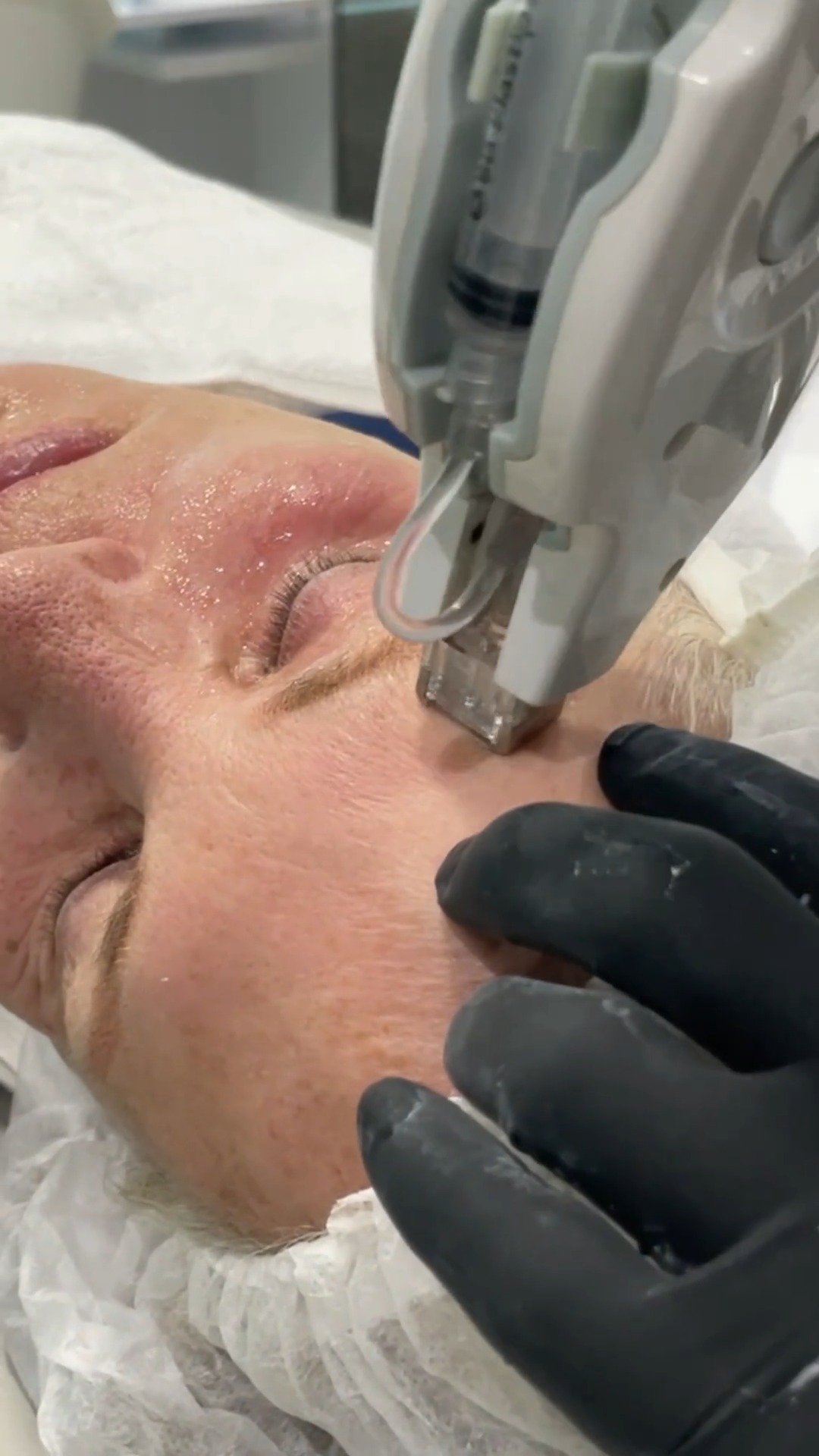 💎 Boost jouw huid met MESOSKIN! 💎
Dankzij de geavanceerde mesotherapie zonder naalden dringt MESOSKIN diep in de huid door om krachtige serums af te geven – voor directe hydratatie, een stralende glow en een verjongend effect! 🌟
🔹 Pijnloos & niet-invasief – Geen hersteltijd, alleen resultaten!
🔹 Werkt op diverse huidproblemen – Fijne lijntjes, uitdroging, pigmentvlekken en meer.
🔹 Stimuleert collageen & hydrateert intens – Een stralende, jeugdige huid vanaf de eerste behandeling!
Jouw huid verdient het allerbeste – en met MESOSKIN kan jij het hen bieden! 💖
📩 Stuur ons een bericht voor meer info. Samen zorgen we voor jouw mooiste en gezondste huid! 🚀
#gemeentpelt #acnebehandeling #acnebehandelingen #schoonheidsspecialist #pelt #hasselt #lommel #mol #eksel