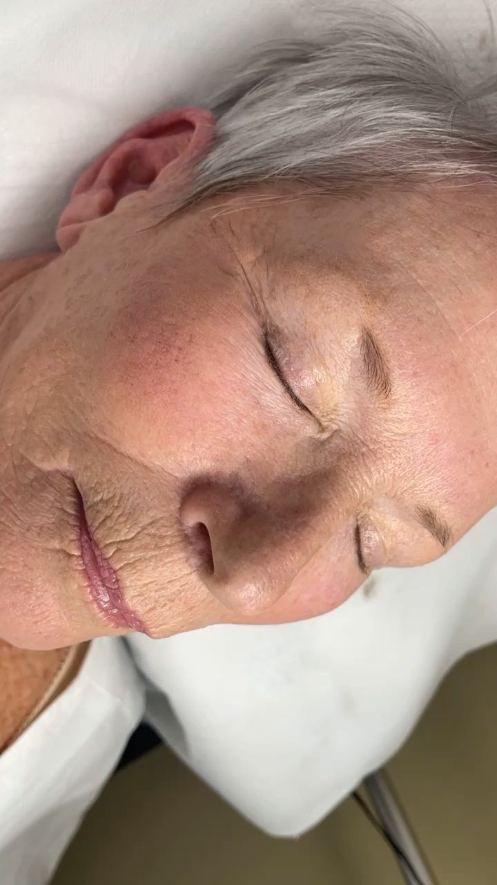 Micropower Brows.....by me
Combine of shading and Microblading to make more even and fuller brows for her...
Do you want one????
.
.
.
Call us for more details
703-850-0030
.
#lybrowstudio #powderbrows #tattooshop #shadingbrows #herndonva #restonva #dmvtattoo