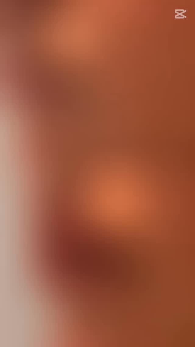 💋 Subtle. Soft. Simply You. 💋
Looking for that effortless, “your lips but better” look?
RHA® Kiss by Teoxane is our go-to for the most natural-looking lip enhancement — designed to move with your expressions and never look overdone. 👄✨
Perfect for first-timers or anyone who wants volume without the drama.
💉 Ultra-natural finish
🕊️ Flexible and dynamic
⏳ Long-lasting results
Ready to enhance your lips while still looking like you? Let’s talk RHA Kiss. 💌
📍Simply Skin Clinic | DM to book your consultation
#NaturalLips #LipFiller #RHAKiss #Teoxane #SubtleEnhancement #LipGoals #AestheticMedicine