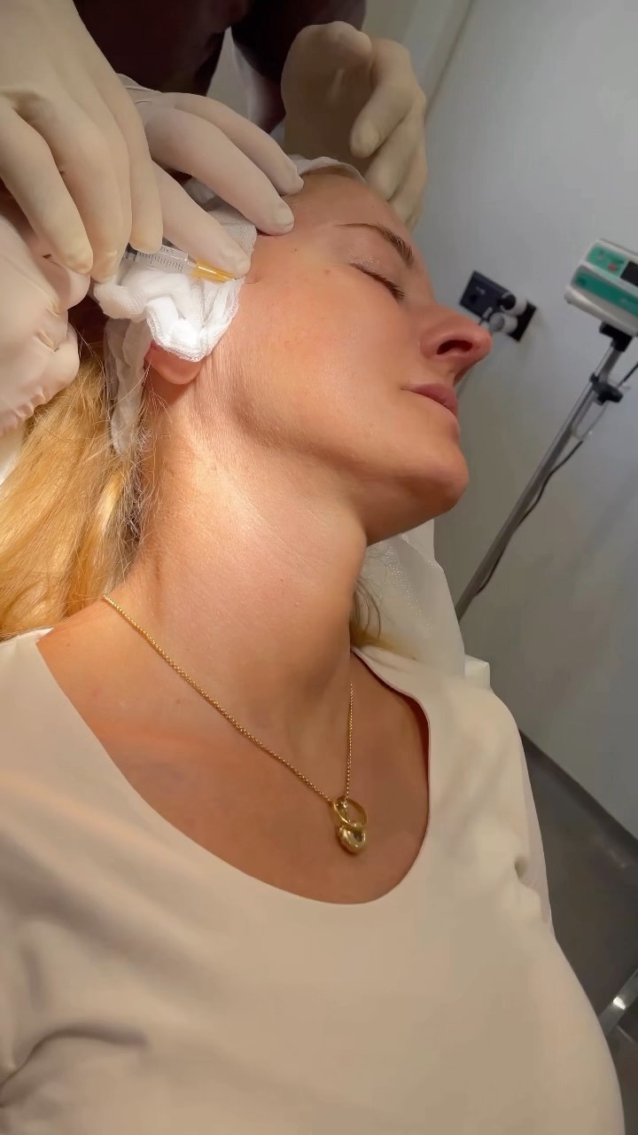 Enhance your natural beauty with Sculptra Treatment. Watch as our expert clinicians sculpt and redefine facial contours for a youthful, refreshed look that lasts. Sculptra is a minimally invasive treatment that stimulates collagen production, resulting in improved skin texture and tone over time.
Ready to experience a transformative difference? Book now and unveil a younger-looking you with Sculptra Treatment!