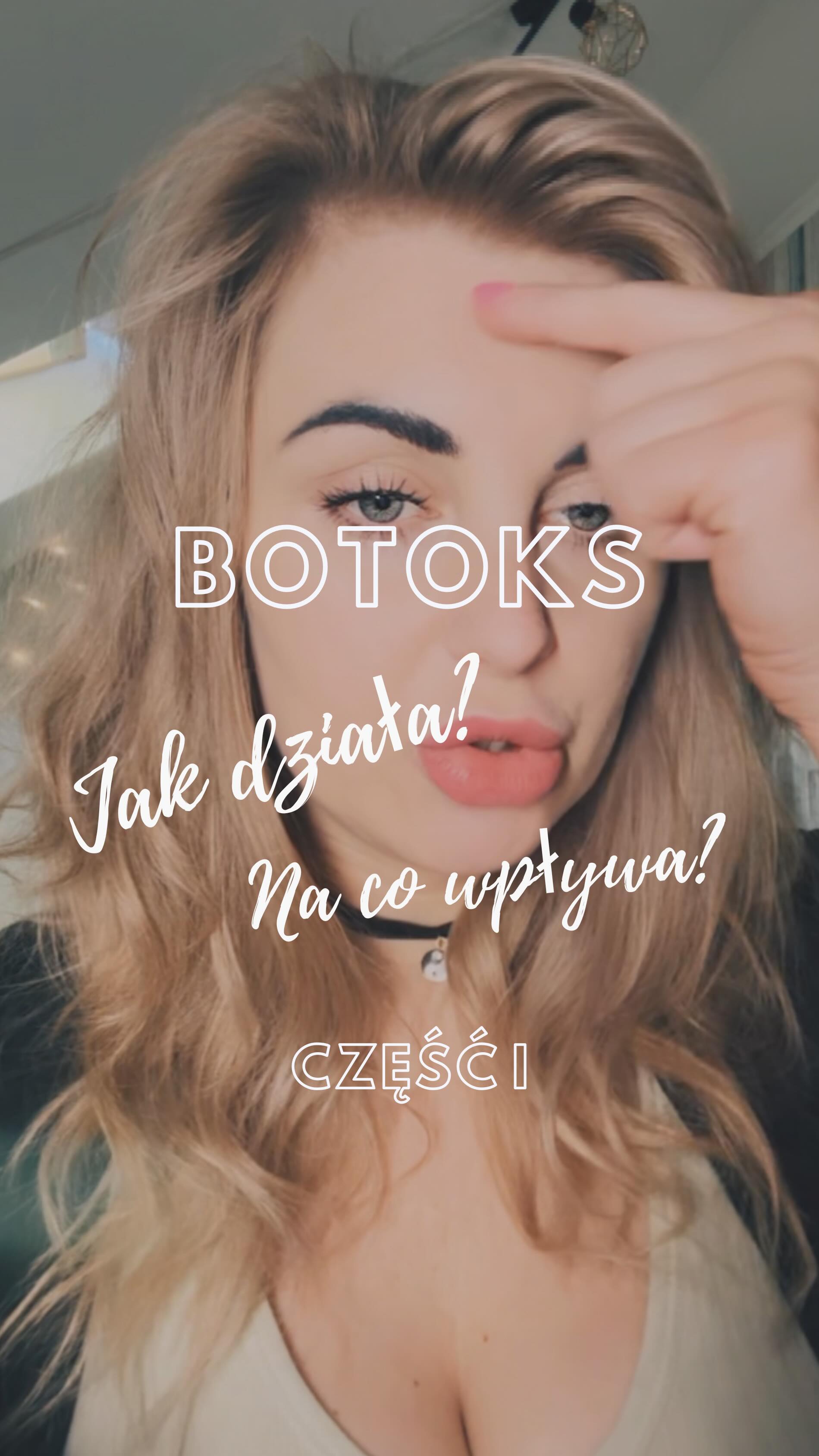 TOKSYNA BOTULINOWA - botoks
DZIAŁANIE I SKUTKI 💉
💉 „Botoks” czyli toksyna botulinowa, to neurotoksyna produkowana przez bakterie Clostridium botulinum. Szeroko i chętnie stosowana w medycynie estetycznej, ma też zastosowanie w medycynie klinicznej.
🧠Botoks hamuje uwalnianie acetylocholiny, co prowadzi do tymczasowego paraliżu mięśnia. Blokując neurotransmitery
😌Po wstrzyknięciu, mięśnie w obszarze aplikacji rozluźniają się, wygładzając zmarszczki mimiczne np kurze łapki, zmarszczki na czole czy linie marionetkowe. Nie ma tu efektu maski czy porcelanowej twarzy wygląda ona na rozluźnioną i wypoczętą ❤️
⏳Efekty działania botoksu utrzymują się od 3 do 6 miesięcy. Po tym czasie mięśnie odzyskują funkcję
NALEŻY PAMIĘTAĆ:
⚖️Jakiś czas Po zabiegu mogą wystąpić zaburzenia równowagi działania mięśni. Kiedy jeden mięsień jest unieruchomiony, inne mięśnie muszą przejąć jego funkcje i pracować intensywniej. Prowadzi to do zwiększonego napięcia w innych obszarach twarzy, co z czasem może prowadzić do nowych zmarszczek i dyskomfortu.
Botoks generalnie jest bezpieczną substancją. Kiedy zabieg wykonany zostanie przez profesjonalistę wszystko powinno by w porządku.
Jak każdy zabieg niesie ze sobą zalecenia i przeciwwskazania.
Czy więc masaż i botoks wykluczają się wzajemnie ? 🧐
Obejrzyj następną rolkę by się tego dowiedzieć 😉😙
Selfcare=Selflove
*linki do źródłowych materiałów zdjęciowych w rolce
Kontakt
📲 451 060 072
👩🏼💻 studiobalans.booksy.com
👩🏼💻 studiobalans-niepolomice.pl
📍 Ul. 3 Maja 13 Niepołomice
❗️Nr rejestru Instytucji Szkoleniowej : 2.12/00050/2024
#botoks #toksynabotulinowa #kosmetologia