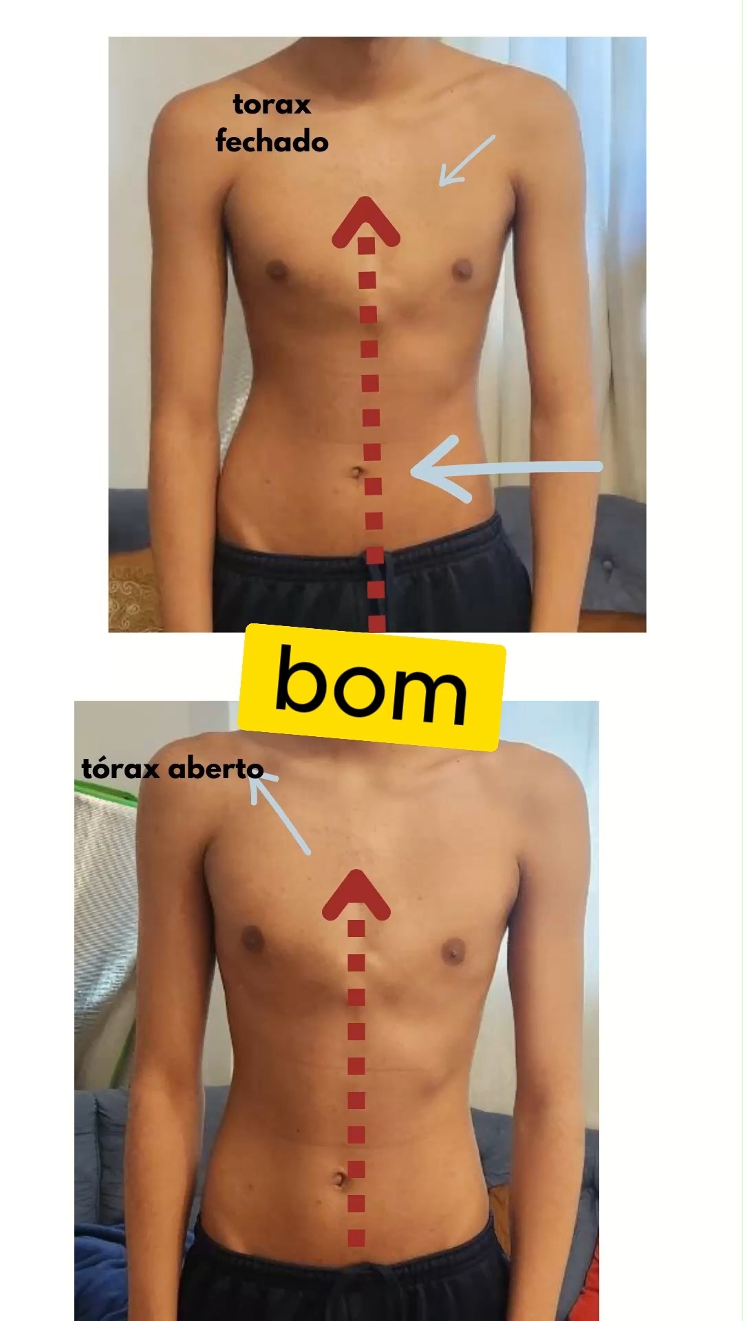 Estética e Postura é o de menos, com este trabalho liberamos as tensões profundas no corpo.
.
.
.
.
#postura #terapiamanual #terapiamanuale #manualtherapy #therapiemanuelle #osteopathie #osteopathy #osteopatia