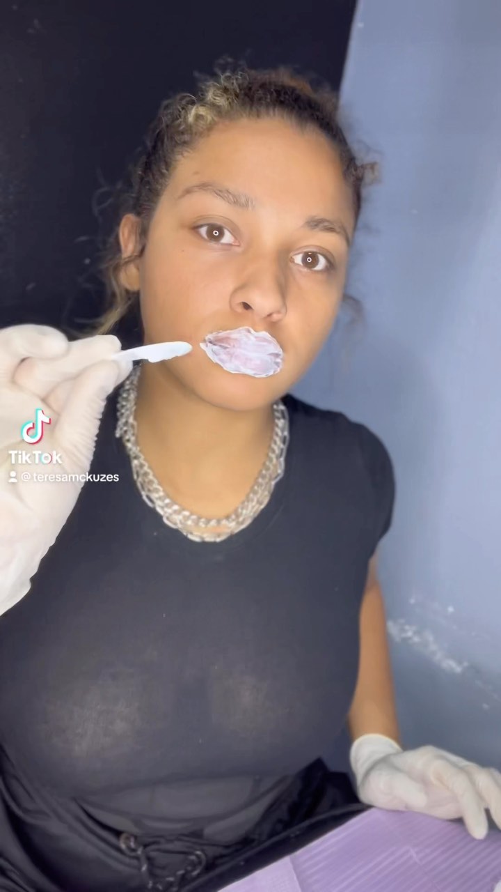 Let’s do some lip fillers 💕🫶🏽 Pros to doing micro needling vs regular needle: •less healing time •minimal pain •minimal bruising •won’t hit any blood vessels (therefore making it safer) •lasts around the same time as regular needle 12-18 months 🤝🏾🫶🏽 #lipfillers #microneedle #bossslay #tampalips #tampalashes #tampafillers #sarasotalipfiller #bradentonlashes #sarasotalashes #hair #protectivestyles #explore