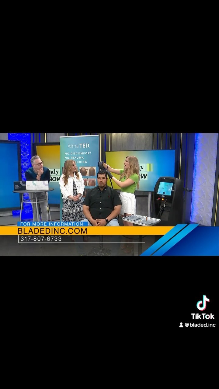 Behind the scenes of our segment demonstrating our cutting-edge hair restoration device! ๐
Discover the magic happening in our studio as we help you regain your confidence and achieve luscious locks. Stay tuned for more updates and transformations! #HairRestoration #BehindTheScenes #hairloss #hairgoals #almalasers #almapartner #almatedsouthflorida