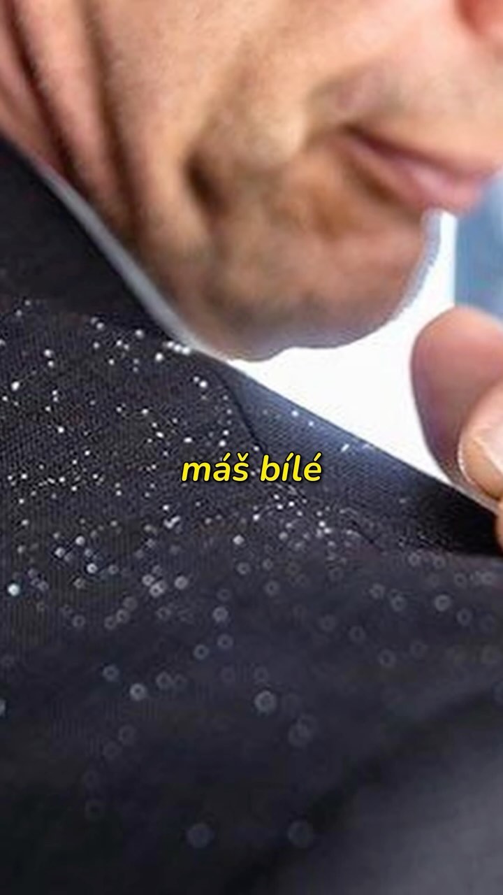 LUPY A SUCHÁ POKOŽKA
Vyzkoušej vlasové oleje! Pokud chceš vsadit na jistotu zvol olej obsahující vitamín C, ten ti zajistí pořádnou dávku hydratace vlasové pokožky i vlasů. Pro zmírnění zarudnutí a svědění sáhni po Tea tree, nebo jojobovém oleji.
Pro více tipů nás sleduj!