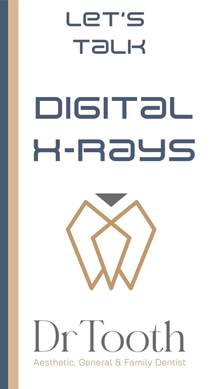 Part 2 of our Let’s talk tech series. Dental digital X-rays have revolutionized the way dentists diagnose and treat oral health issues. Unlike traditional film X-rays, digital X-rays use a sensor to capture images that are immediately displayed on a computer screen. This eliminates the need for chemical processing, making the process faster and more environmentally friendly. The digital images are also of higher quality, providing dentists with sharper and more detailed views of teeth, bones, and surrounding tissues. This enhanced clarity enables dentists to detect subtle abnormalities, such as cavities, bone loss, and impacted teeth, at an earlier stage. Early detection is crucial for effective treatment and can prevent more serious complications from.
