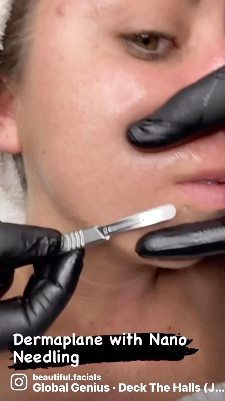 Derma-Plane exfoliates and removes vellus facial hairs(peach fuzz) Nano Needling infuses select serums and can be combined with derma-plane 👌