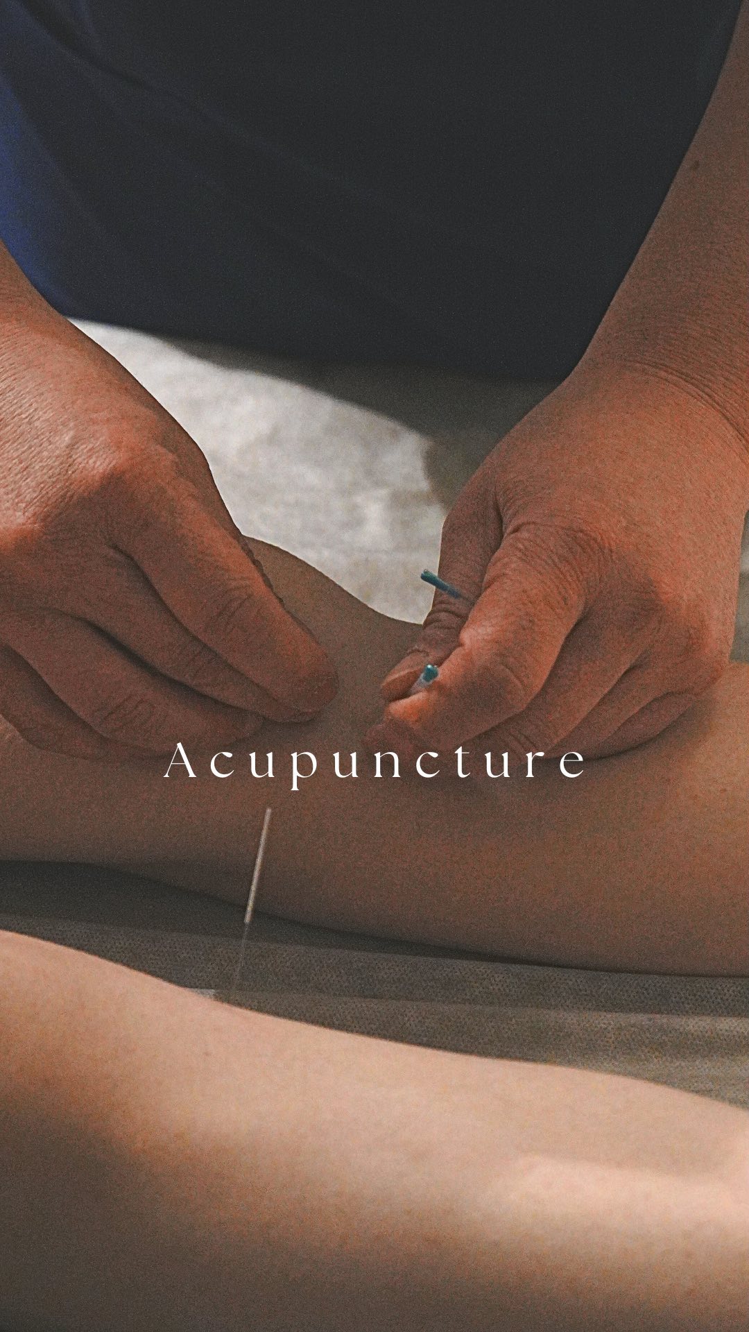 Have you been dealing with back pain, migraines, or muscle tension? Wondering if thereโs a natural way to feel better?
Discover the ancient art of acupuncture โ a gentle, time-tested therapy that works to:
โ Reduce discomfort naturally
โ Improve circulation and energy flow
โ Bring you long-lasting relief
Whatโs stopping you from living pain-free? Take the first step toward a healthier, more relaxed version of yourself. Weโre here to help!
๐ Visit us at: 97 Southampton Row, Holborn, London, UK, WC1B 4HH
โ Call now: 020 8076 8880
๐ง Email: phcholbornlondon@gmail.com
๐ WhatsApp: +447881308123
#RelaxationRituals #SelfCareMoment #TCMP #ChineseMassage #TraditionalTherapy #Relaxation #LondonWellness #HolbornMassage #StressRelief #Rejuvenation #BodyAndMindBalance #AcupunctureHealing #PainRelief #HolisticHealth #PerfectHealthCentre #BetterSleep #TCMHealing #AcupressureTips #InsomniaHelp #HolisticHealth