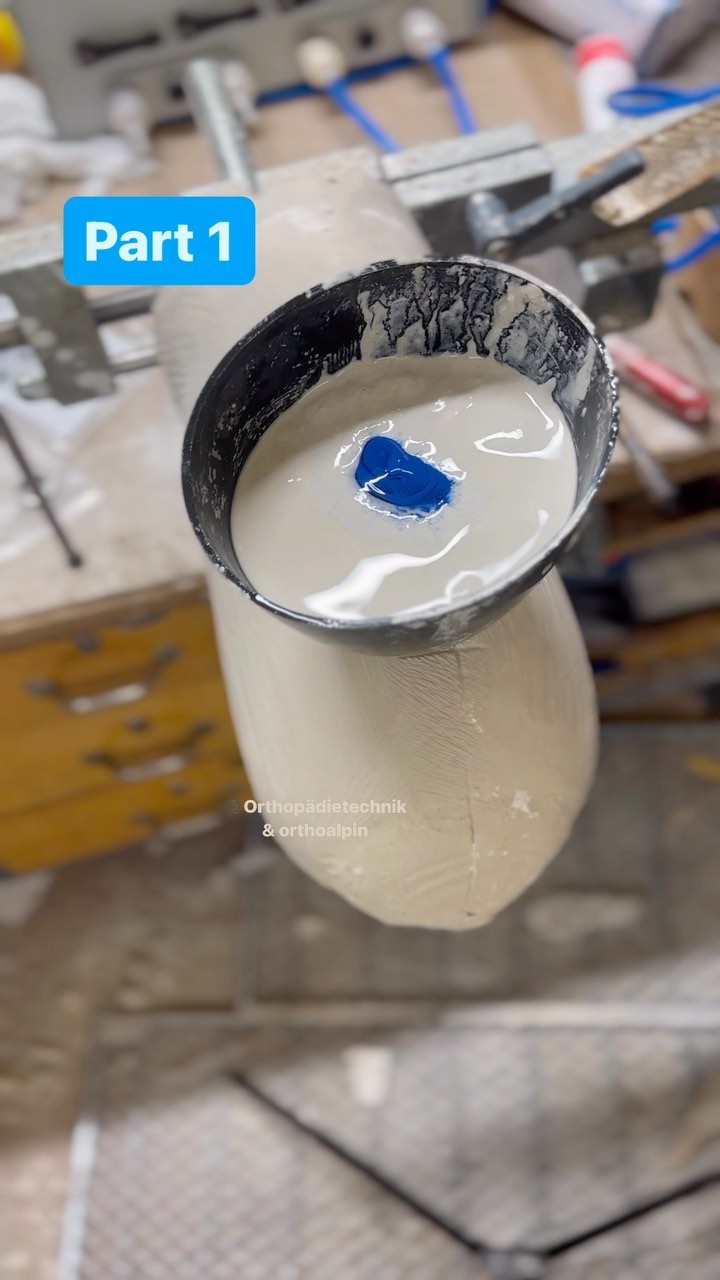 Teil 1 (von voraussichtlich 5) einer kleinen Video-Reihe zur Anfertigung einer Unterschenkelprothese.
Hier nun die Gipspositiv-Modellierung.
Ich mache das nicht immer gleich. Abhängig vom System und Patienten variiert meine Gipsmodelliertechnik.
🇬🇧Part 1 (of aprox. 5) of a tiny how-to BK prosthesis. This part is about how I do the modeling of the plaster model.
I don’t do it like this only, but I vary in the technique, depending which socket-/locking-system I use and how the customer will need it.
#orthopädietechnik #oandp #unterschenkelprothese #prosthesis #belowkneeprosthesis #prothese #prosthetics #beinprothese #prostheticleg #amputiert #amputee #amputeelife #lifestylemedicine #handwerk #handmade #handcrafted #handarbeit #immerweiter #lustaufhandwerk #custommade #meinhandwerkhilft