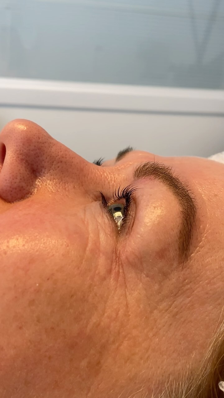 ✨L A S H L I F T ✨
Een lashlift is een fantastische manier om je natuurlijke wimpers een prachtige krul te geven, zonder dat je dagelijks een wimperkruller of mascara hoeft te gebruiken. Bij een lashlift worden je wimpers semi-permanent omhoog gelift en gekruld, waardoor je ogen groter en frisser lijken. Het resultaat blijft 6-8 weken zichtbaar. Het is perfect voor wie een natuurlijke look wil met een vleugje glamour!
+ Langdurige krul, tot 8 weken
+ Natuurlijk uitziende wimpers
+ Geen wimperkruller of mascara nodig
+ Snel en pijnloos proces
+ Geschikt voor elke wimperlengte
#LashLift #NaturalBeauty #Wimperkrul #lashextend #NoMascaraNeeded✨