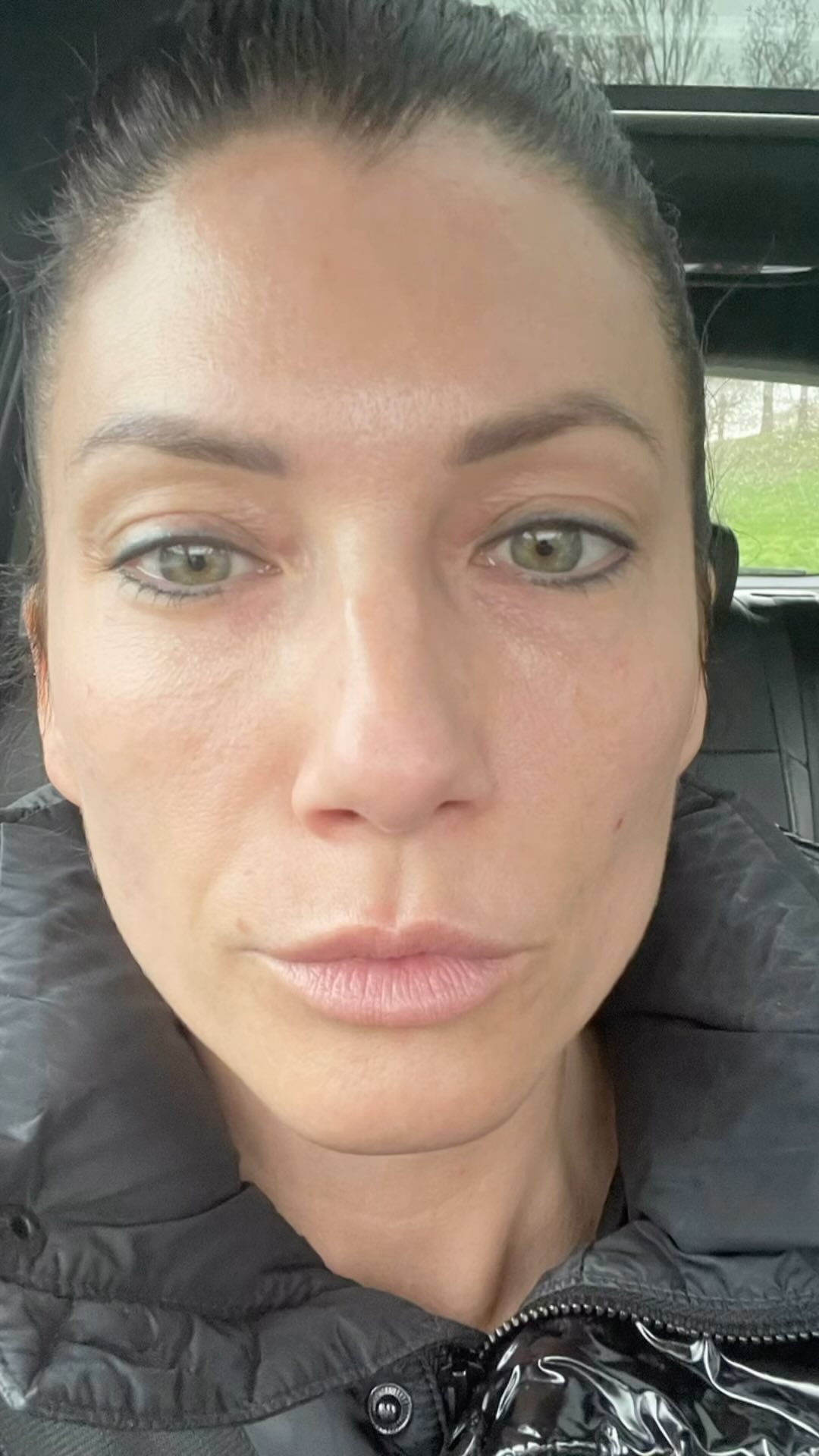 #treatment #cosmetics #mesofillr #mesohel #skinskincare #fashionbeautyszepsegszalon @fashionbeauty_szepsegszalon