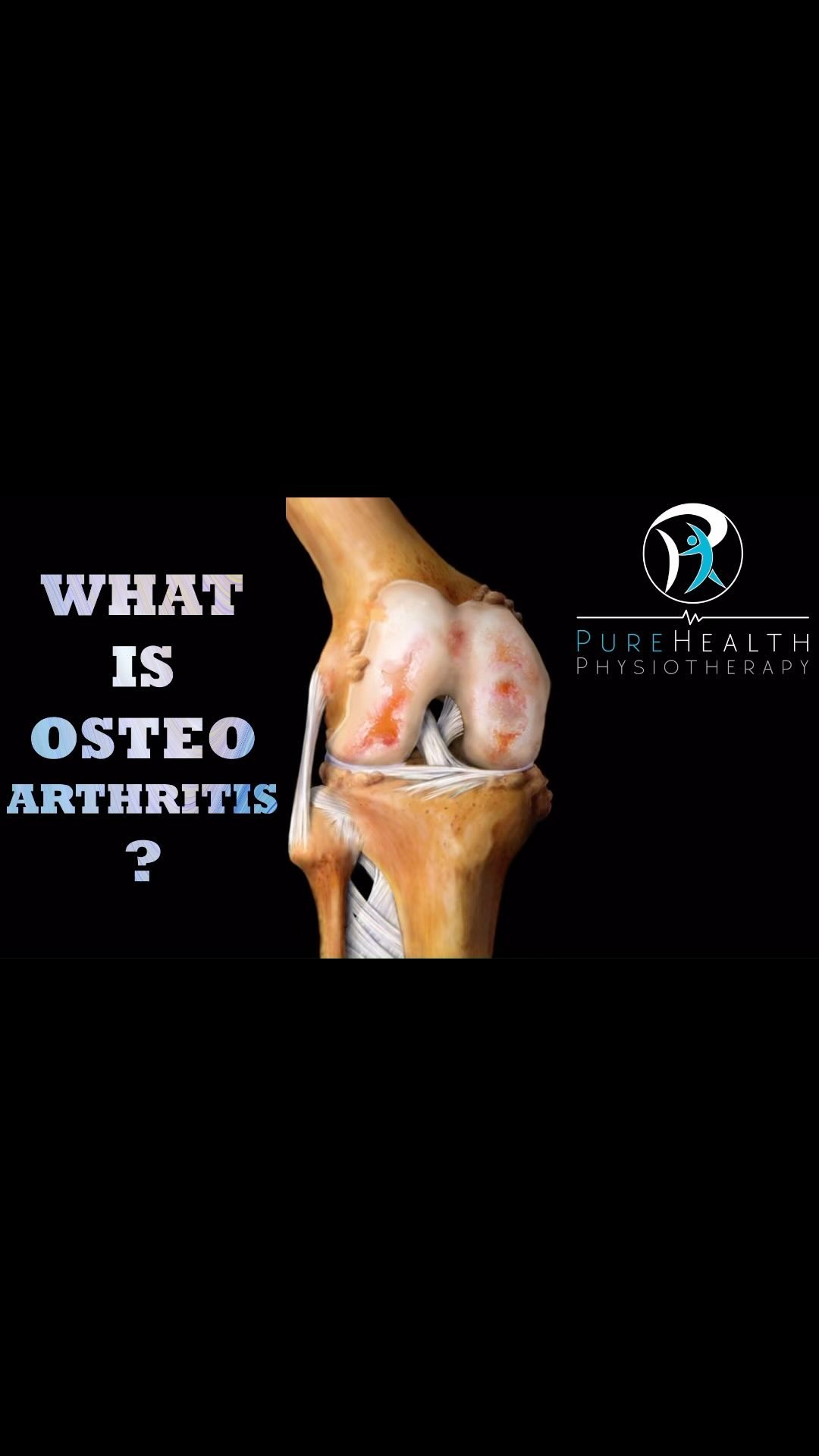 A brief tutorial on Osteo Arthritis and how to manage it.
👇🏼For more information contact us on👇🏼
07443419973
Info@purehealthphysio.co.uk
www.purehealthphysio.co.uk
#physiotherapy #sportsrehab #sportsmassage #osteoarthritispain #osteoarthritisawareness #oa #oapainrelief #dryneedling #acupuncture #health #sunburyonthames #feltham #thegymsunbury #thegymfeltham #ashfordmiddlesex