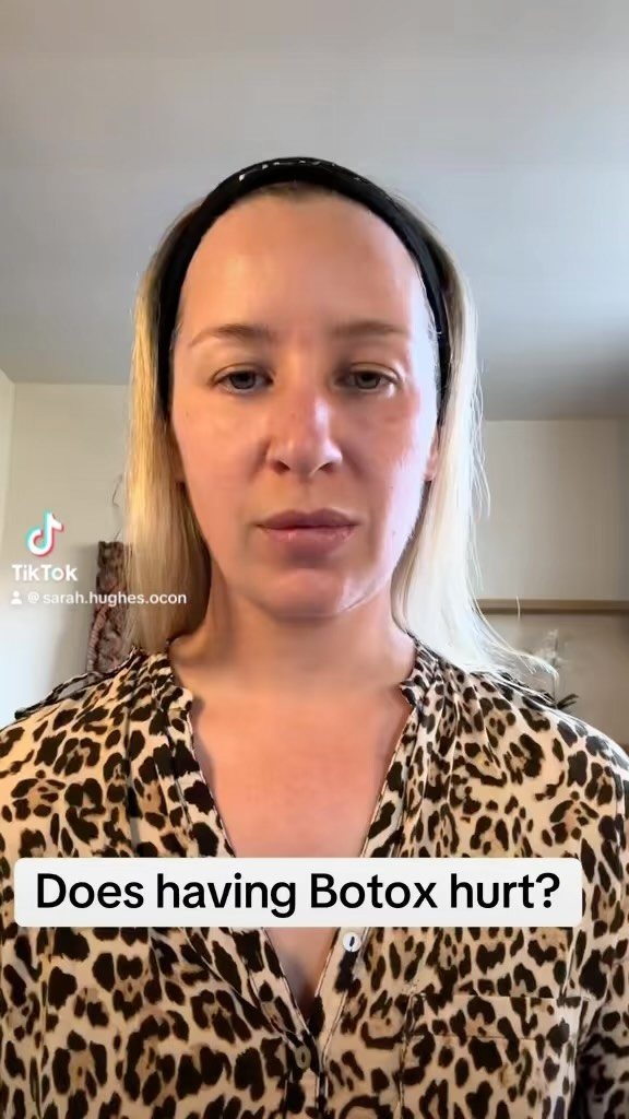 What’s it like having Botox? I’ll show you. Don’t forget aftercare: when cleaning face not to rub around your eyes- up & away from the eye area pls, don’t wear make up, if you must mineral powder SPF 50, stay out of the sun/sauna/sunbeds. No flights. No sticking your head through the hole in the massage/physio/chiropractor. #botoxlondon #botoxsouthlondon #antiwrinkle #betteryou