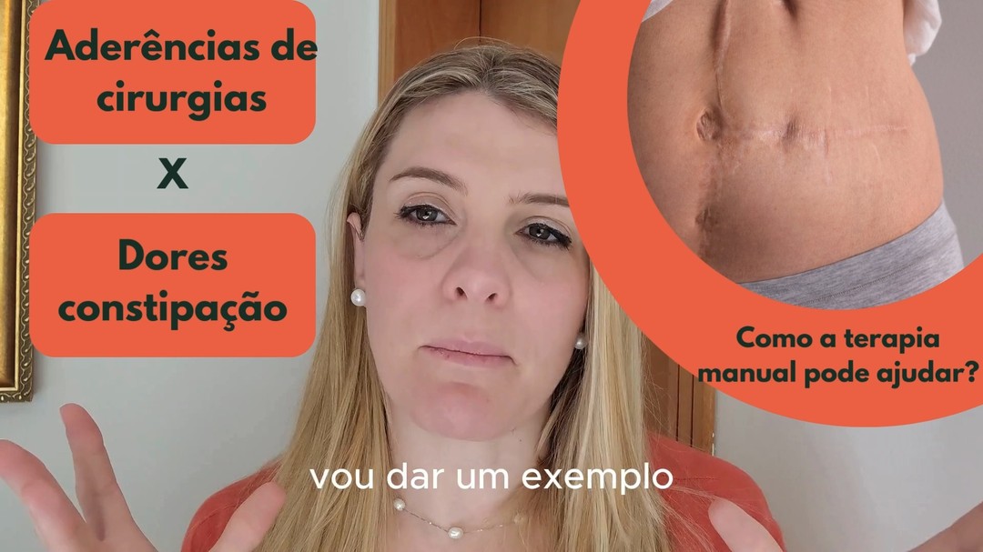 #cicatriz #abdominoplastia #cicatrizcesarea #terapiamanual #osteopatia #constipação #constipation