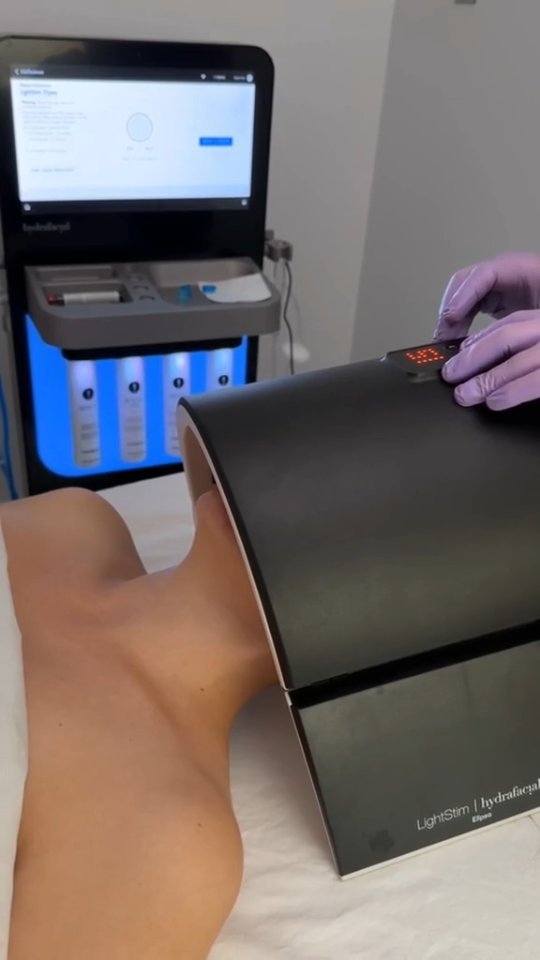 Taking care of my skin with a HydraFacial 🧖🏻♀️ Had such a lovely time with Concord Med Spa.