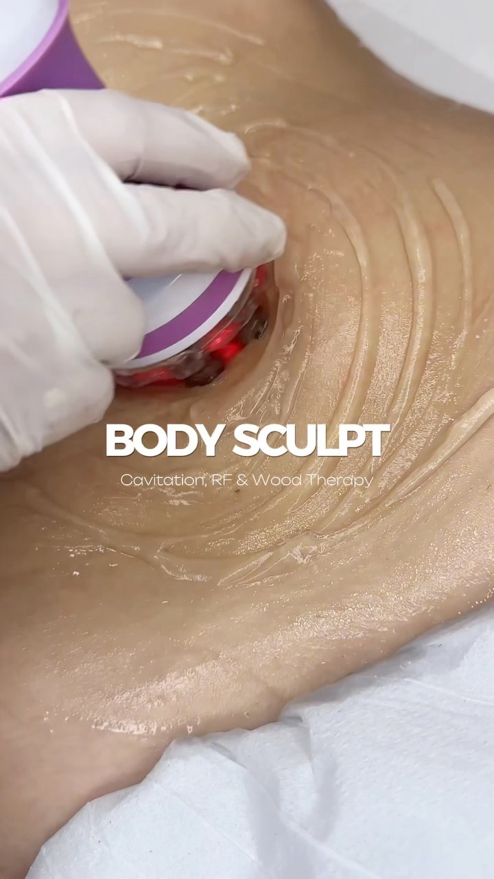 Experience the ultimate in body sculpting and rejuvenation with our comprehensive combination treatment. This unique session integrates four advanced techniques to enhance your body’s natural beauty and promote overall wellness.
1. Radio Frequency
Radio frequency therapy uses advanced technology to deliver heat energy deep into the skin layers. This process stimulates collagen production, tightens skin, and reduces the appearance of fine lines and wrinkles. It’s an effective, non-invasive method for achieving a more youthful and toned appearance.
2. Wood Therapy
Wood therapy, also known as maderotherapy, employs specially designed wooden instruments to massage and sculpt the body. This technique helps break down stubborn fat deposits, reduce cellulite, and improve lymphatic drainage. The natural, rhythmic movements stimulate blood circulation and enhance the skin’s elasticity.
3. Cavitation
Cavitation uses low-frequency ultrasound waves to target and disrupt fat cells beneath the skin. This painless procedure breaks down fat cells, which are then naturally eliminated by the body’s lymphatic system. Cavitation is particularly effective for reducing localized fat deposits and contouring the body.
4. Lymphatic Drainage Massage
Lymphatic drainage massage is a gentle technique that encourages the movement of lymph fluids around the body. This type of massage helps remove toxins, reduce swelling, and improve overall circulation. It’s an excellent way to enhance the body’s natural detoxification process and boost immune function.
Benefits of the Combination Treatment
Achieve firmer, smoother skin with the collagen-boosting effects of radio frequency.
Cellulite Reduction: Minimize the appearance of cellulite and improve skin texture with wood therapy.
Body Contouring: Target and reduce stubborn fat deposits for a more sculpted physique through cavitation.
Detoxification and Circulation: Promote overall health and well-being with the detoxifying effects of lymphatic drainage massage.
#bodycontouring #sculpting #weightloss #4u #knightsbridge