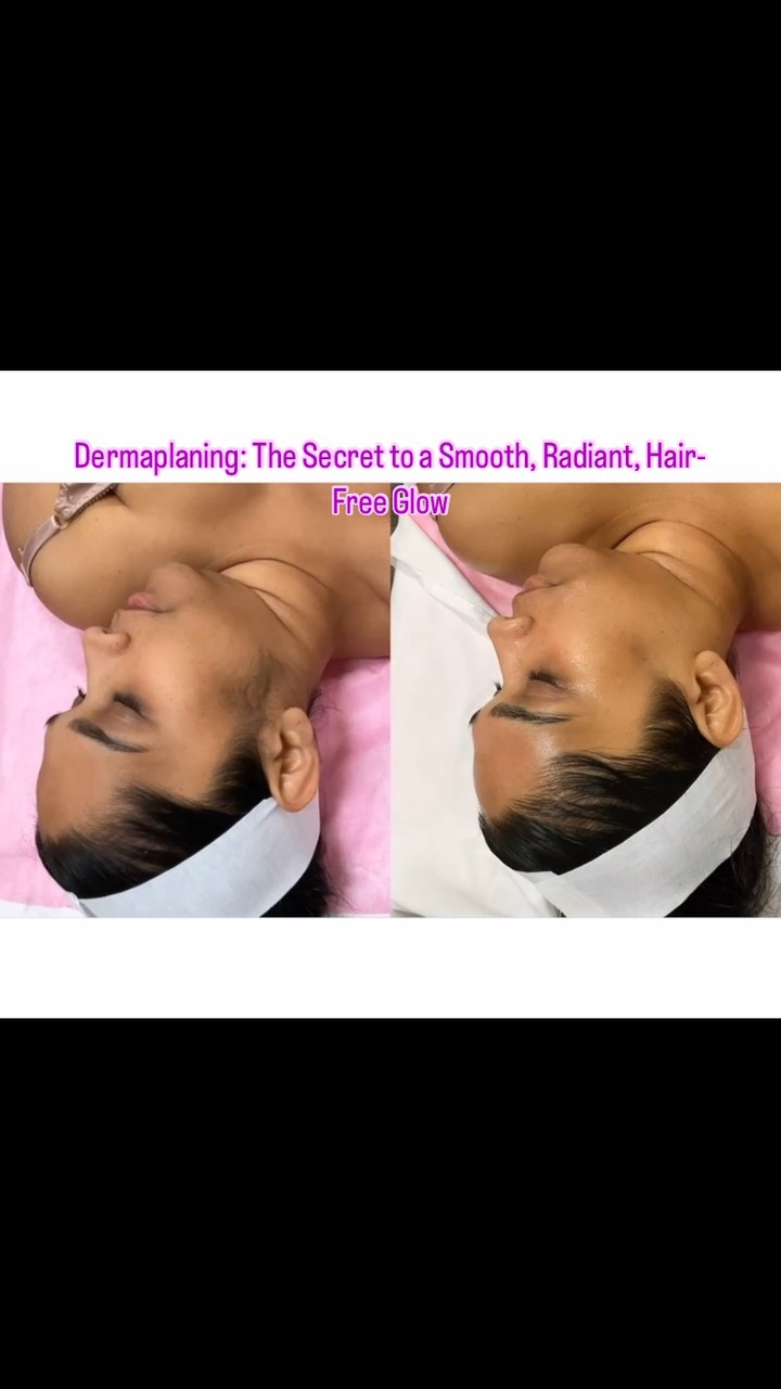 #capricebeautybar #theskingames2024 #age #tampabay #age #sarasotaflorida #medspa #skin #dermaplainingfacial #dermaplaning #peels#skirejuvenation #bestskin #venicefl #laekwoodranch