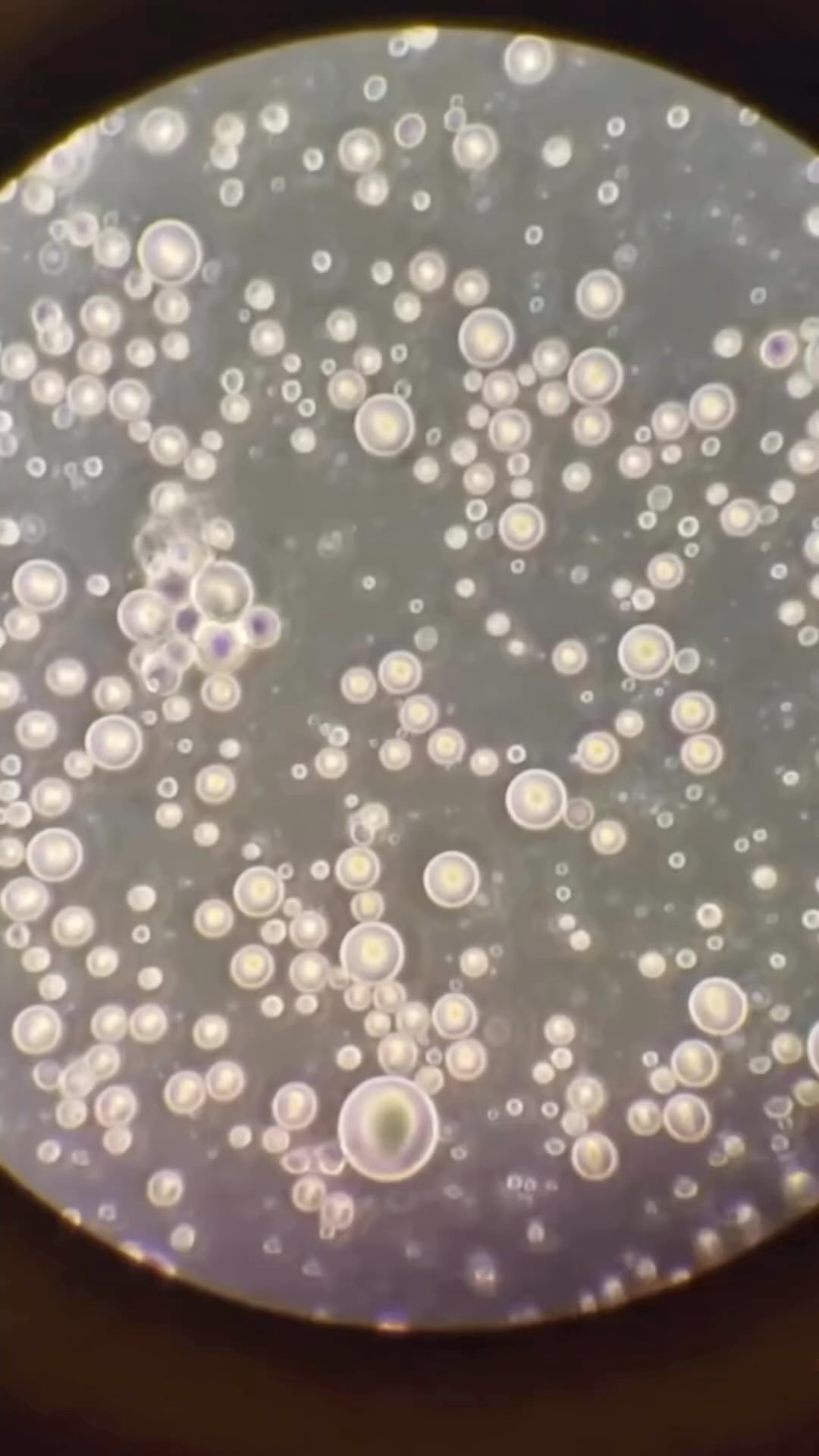 The MAGIC of breastmilk ✨
✨ Breastmilk Is Alive: Breastmilk is packed with living cells, including stem cells, which can develop into different types of cells in the baby’s body, aiding in tissue repair and organ development. This means breastmilk isn’t just food; it’s a living substance that actively contributes to your baby’s growth and healing. In fact, one teaspoon of your breastmilk has as many as 3 million germ-killing cells in it!
✨ Breastmilk Adapts to Baby’s Needs: Breastmilk isn’t static; it changes to meet your baby’s needs. For instance, if your baby is sick, your body will increase the production of antibodies in your milk to help fight the infection.
✨ Packed with Over 1,000 Proteins: These proteins not only help in the growth and brain development of your baby but also strengthen their immune system, offering protection against infections.
✨ Reduces Risk of Diseases: Breastfed babies have a lower chance of developing ear infections, respiratory issues, and gastrointestinal diseases. Mothers benefit too, with a reduced risk of breast and ovarian cancer, heart disease, and type 2 diabetes.
✨ Uniquely Tailored: Every mother’s breastmilk is customized to her baby’s specific nutritional needs, making it unique even in cases of twins nursing separately.
video: FB/ Jansen Howard “My dad is a blood microscopist and this is a single drop off my breast milk under his microscope!!!! It’s miraculous and it’s ALIVE…”
photo: beautiful mama of 3: @ashleytobin29
Repost @amber.birth