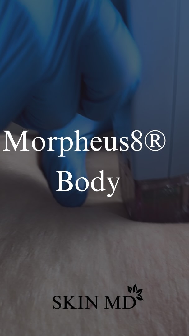 Transform your body with precision and confidence using Morpheus8 Body! Sculpt, tighten, and enhance your natural beauty with cutting-edge technology. #morpheusoakville #bodytransformation #bodycontour