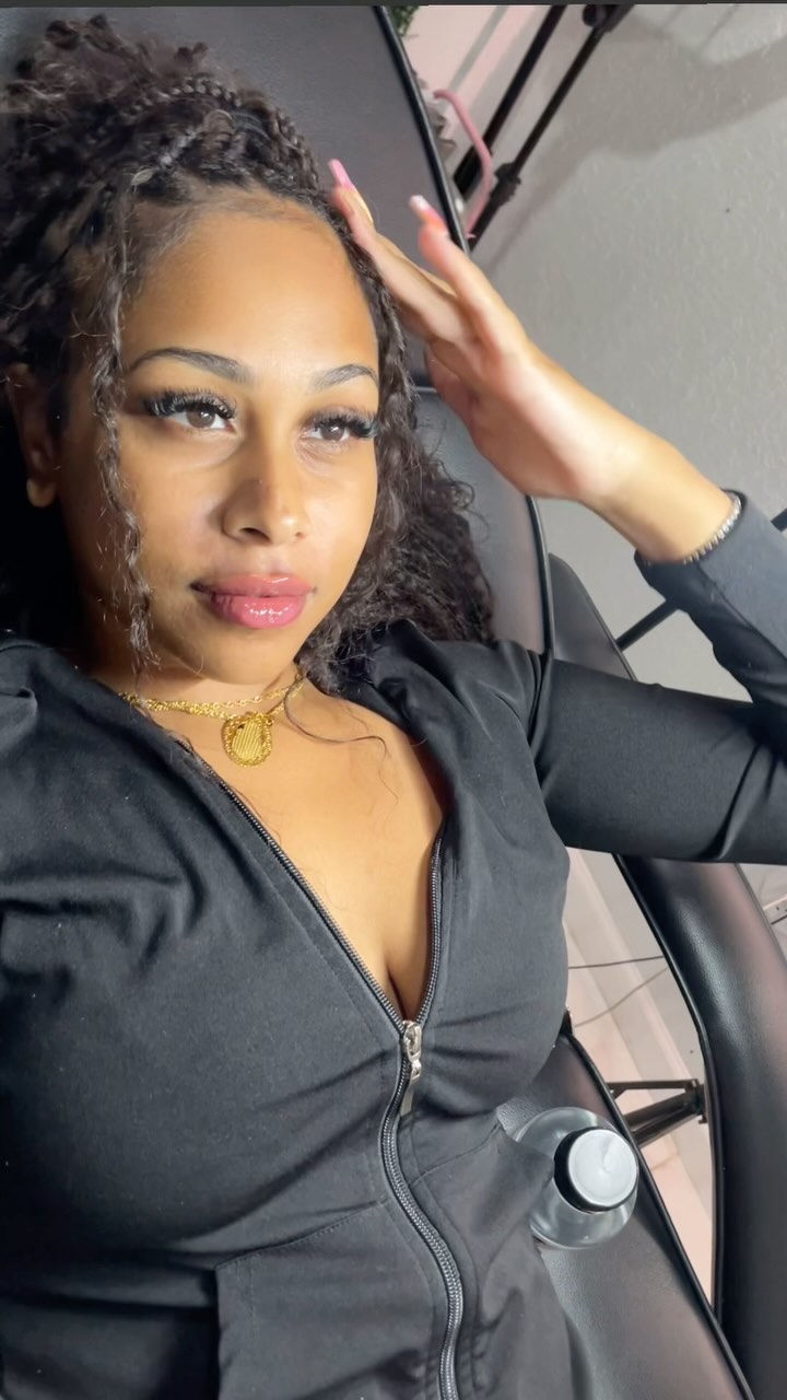 0.5 mL injected ๐๐ using microXhyaluron combo Bookings available ๐ค Tampa ๐ Sarasota ๐. #hyaluronpen #hyaluronpentraining #lipfillers #lipinjections #tampalips #tampalashes #lashextensions #lipshaping #tampa #sarasotalipblush