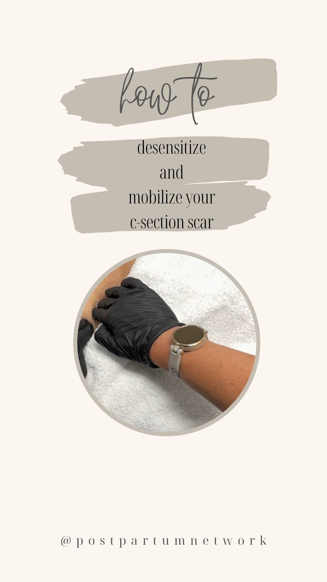 Join us as Dr. Molly provides a detailed step-by-step guide on how to desensitize and mobilize a C-section scar. Perfect for new moms or really any mom that’s looking to improve their recovery, scar appearance, and regain comfort. Don’t miss these expert tips! Share with the c-section mamas in your life. ✨ @mollypierson_dpt 🫶🏽