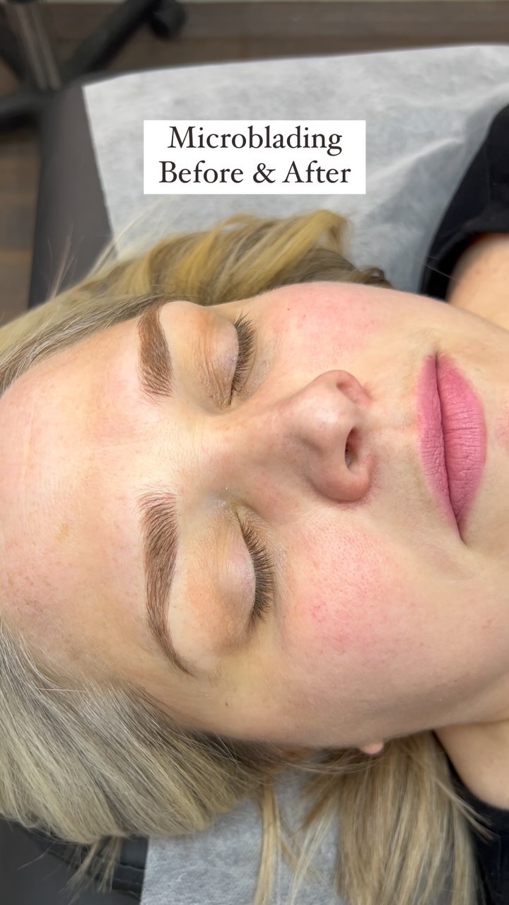 Stop wasting time filling in your brows! Get natural looking results with Microblading.
Microblading is long lasting, customizable and low maintenance.
Book your free consultation and boost your confidence 💋
$450 including touchup
#beauty #microbladingvaughan #eyebrowsvaughan #microbladingwoodbridge #microbladingtoronto #fillertoronto #lipfiller #eyelashesvaughan #eyelashes
