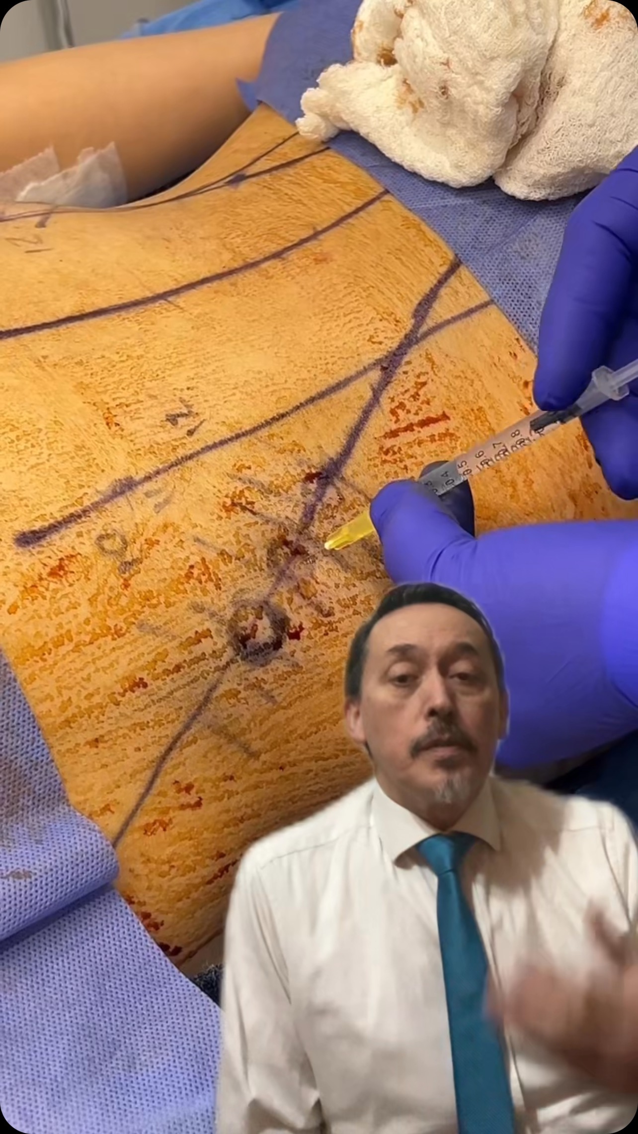 Hoy queremos hablar un poco más de esta increíble cirugía, que otras preguntas tienes? 💞