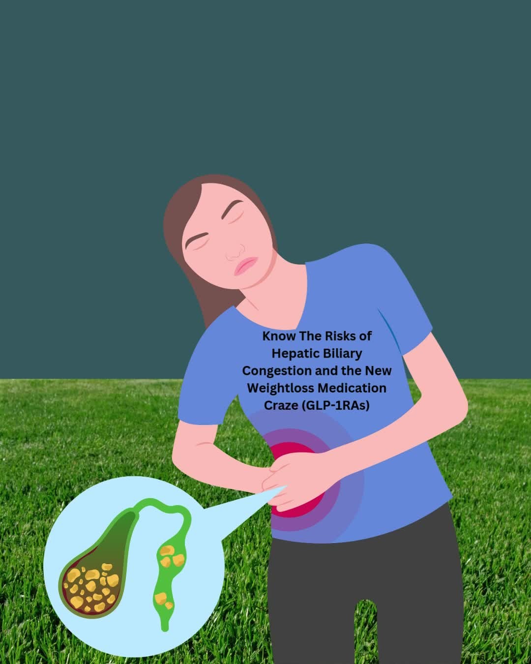 It's essential to understand that individuals using GLP-1 receptor agonists for diabetes or weight loss may already have existing hepatic-biliary congestion. These medications can decrease gallbladder motility, thereby heightening the risk of gallstones and gallbladder disease.
It would be wise to consider proactively supporting the liver and gallbladder prior to taking GLP-1s in order to counter this risk and ensure ongoing detoxification health. And if someone has had a cholecystectomy (gall bladder removal) you must consider what was at play upstream that led to the diseased organ. Just because a diseased organ is removed doesn’t mean the upstream factors causing it have gone away.
Partnering with a functional medicine coach is a great option to support you on your weight-loss journey. Functional nutrition counselors help guide, educate and empower clients to enhance their metabolic health. My aim is to help clients lose weight and maintain sustainable weight loss through informed dietary choices and lifestyle practices that will significantly improve overall well-being.
.
.
.
#walkersfunctionalnutrition
#functionalmedicinehealthcoach
#functionalnutrition
#functionalnutritioncounselor
#functionalnutritioncounseling
#healthcoach
#dietandlifestylecounseling
#empoweryourselfnaturallythroughdietandlifestyle
#personalizeddietandlifestyle
#functionalmedicine #autoimmunity #healautoimmunedisease
#digestivehealth #guthealth #mentalhealth #leakygut #weightloss #hepaticbiliairyhealth
#GLP-1RAs
#womanowned #northamptonma