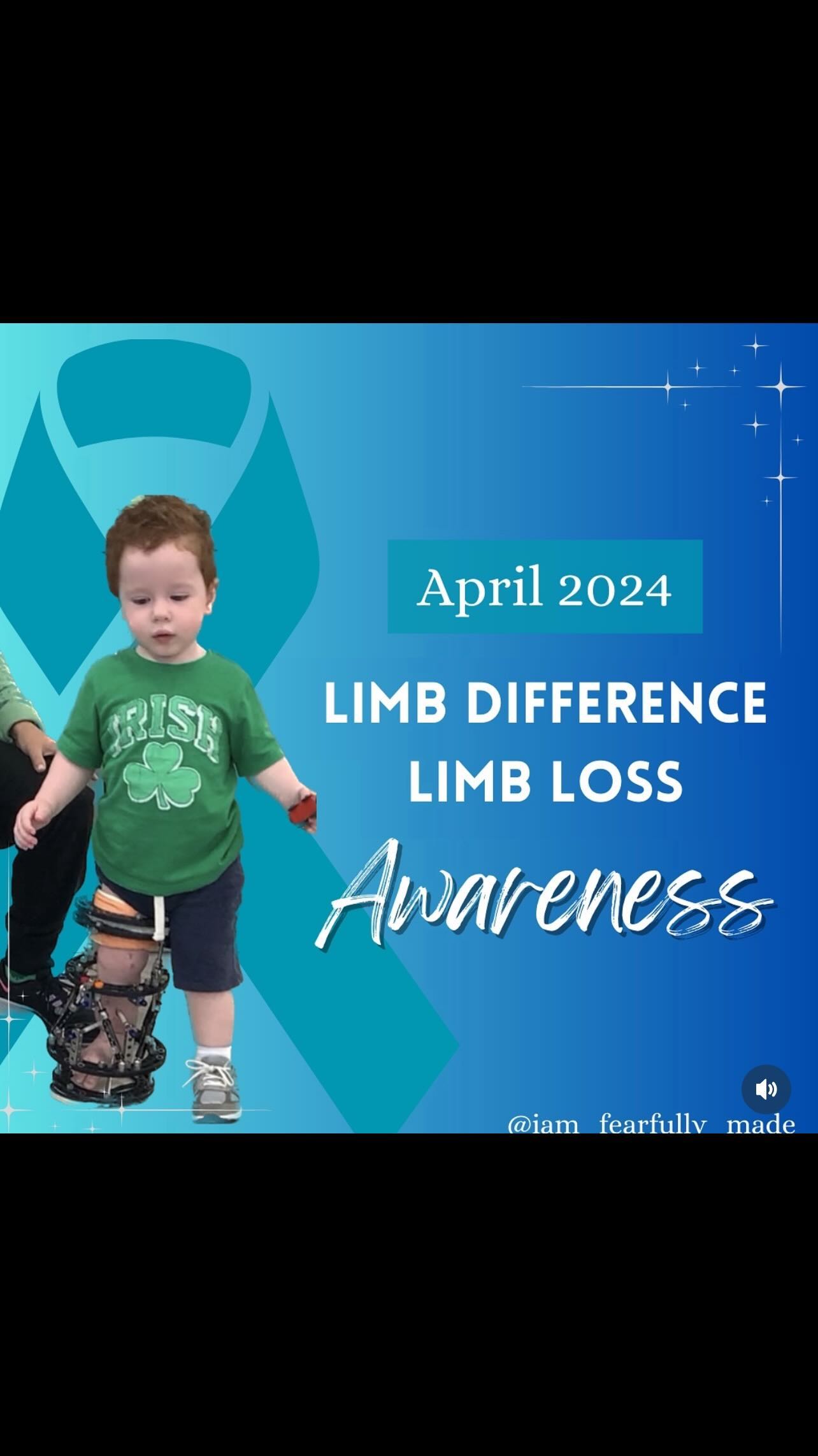 “You shouldn’t have to do this alone 🫶
When I realized I wasn’t alone on this journey, that was a complete game changer for me.
In that moment I knew I wanted to …
🌟Help
🌟Educate
🌟Empower
other families as they navigate their own personal roads. The beginning can be very stressful and overwhelming. Things do get easier with time.
It’s nice to know that there are other individuals in this world who have walked the same path as you and experienced the same feelings and emotions. What a sigh of relief! 😮💨
I hope my page brings you inspiration, hope and joy. Angelo is proof that children with rare conditions can and will live beautiful lives! Come follow along with us and learn what’s it’s like to be rare!! 🙌🦓
♥️Follow @iam_fearfully_made and become a part of this amazing community we have created! “
#Repost with permission from @iam_fearfully_made 🤍🤍🤍
.
.
#limbdifferenceawareness #limbdifferenceawarenessmonth #beautiful #beautifullymade #support #resources #community