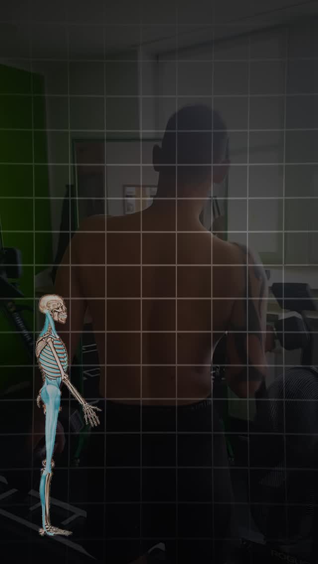 Kender du forskellen mellem relativ og absolut bevægelse? 🤔
Nej?
Så synes jeg, du skal læse med her! 😃
At forstå og lære at udføre de to bevægelsesformer kan skabe mere balance i din krop, give en følelse af stabilitet, mere effektive bevægelsesmønstre og færre spændinger og smerter. 🙏🏻
Absolut bevægelse
Kort fortalt er absolut bevægelse den måde, vi oftest bevæger os på i dagligdagen. For de fleste mennesker gælder det også i forbindelse med træning eller genoptræning. 👌
Men hvad betyder det egentlig?🕵️♂️
Når vi bevæger os “absolut”, bevæger vi os i rummet omkring et fast punkt. Et eksempel på en øvelse med absolut bevægelse kunne f.eks. være et dødløft.
Og ja – det er absolut vigtigt at træne denne type bevægelse!
Vi mennesker er skabt til at bevæge os i rummet: fremad, fra side til side (kontralateralt) og i rotationer.
Men faktisk bruger vi i naturens design ofte relative bevægemønstre til at skabe kraft.
Relativ bevægelse👩🎓
Hvad er relativ bevægelse så?
Relativ bevægelse er, når kroppens dele bevæger sig modsat hinanden i rummet.
Et godt eksempel er den mest grundlæggende bevægelse, vi har: gang.🏃♂️➡️
Her bevæger brystkassen sig relativt til hofte/bækkenområdet for at skabe stabilitet og kraft.
Disse principper gør sig gældende mange andre steder i kroppen, f.eks. i relationen mellem nakke og skulderblade eller mellem brystkasse og hoved.
At forstå og aktivt bruge denne viden i både træning og behandling åbner op for helt nye muligheder – og kan føre til store resultater. 👑
Har du udfordringer med bevægelse, smerter eller længerevarende problemer, som ikke er blevet løst?⬇️
Så er det vigtigt at se på hele kroppen – og hele dig.
Du er nemlig en helhed!🎯
Skriv gerne til mig, hvis du har brug for hjælp. #biomekanik #holisitichealth #holisticoaching #rotation #bevægelse #rehabilitering #smertefri #balance #performance #vejrtrækning #nervesystemet #funktioneltræning #behandling #fascia