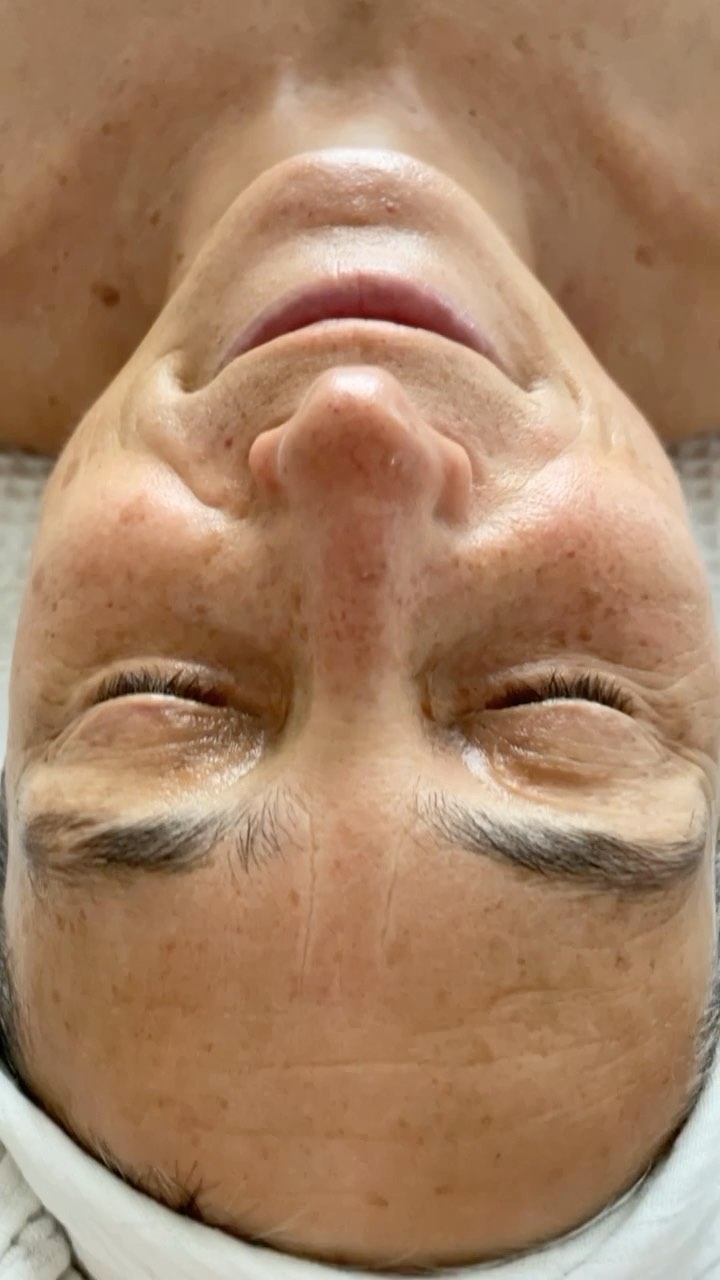 Discover the magic of LED light therapy for glowing skin! ✨
Have you ever dreamed of a skincare treatment that is both relaxing and effective?
Look no further! LED light therapy is here to revolutionize your beauty routine!
At my salon, I offer a unique treatment that combines the power of LED light with advanced techniques for exceptional results.
LED light penetrates deep into the layers of the skin, stimulating collagen and elastin production, reducing wrinkles and hyperpigmentation, and restoring your face to its natural glow.
Lie down comfortably and let yourself be transported by the soft LED light. This treatment is a true moment of relaxation and well-being for your skin and mind.
Are you on vacation in Amsterdam and looking for a relaxing and effective skincare treatment?
Look no further and come visit me! I would be delighted to introduce you to the benefits of LED light therapy and offer you an unforgettable beauty experience.
Give yourself a unique beauty gift and enhance your skin in the heart of Amsterdam!
My customer is so satisfied that she can't help but smile!😉😀🥰
LEDlighttherapy #skincare #antiaging #antipigmentation #glow #Amsterdam #beauty #wellness #relaxation