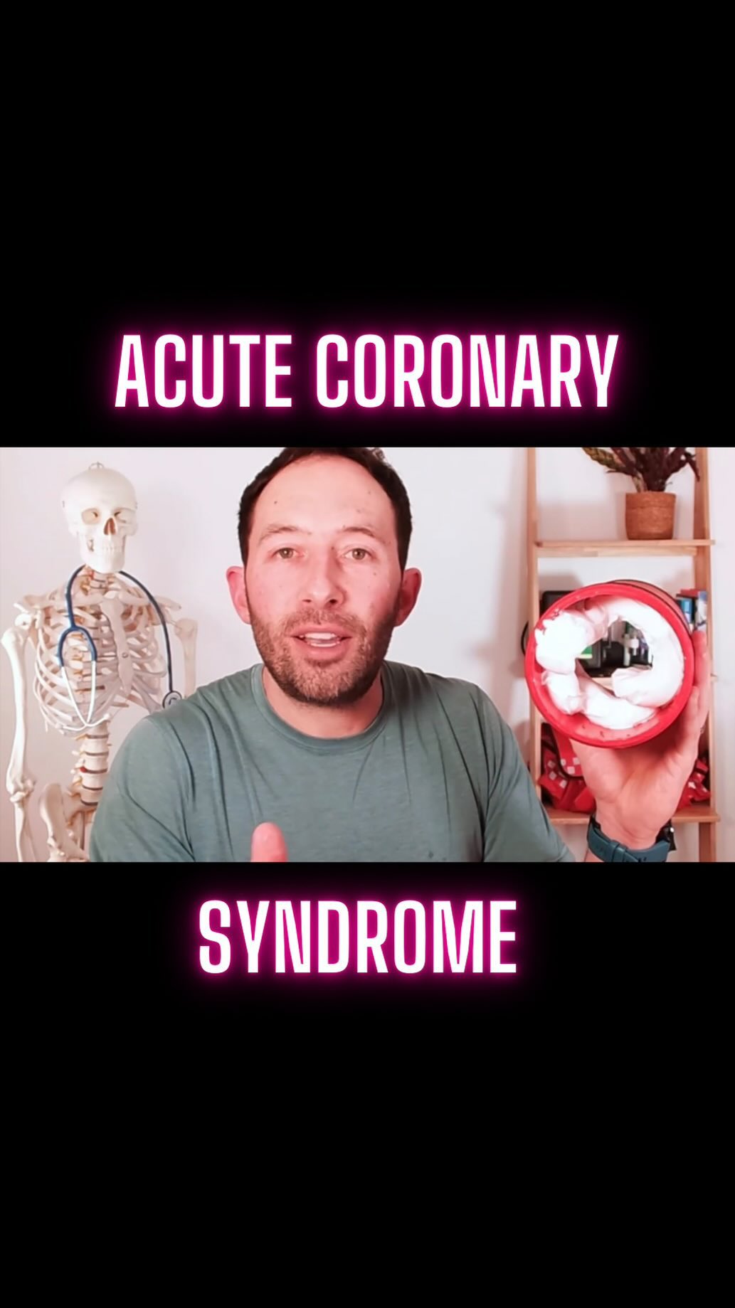 The wonders of modern medicine!
I still think it’s completely crazy that we live in an era where a patient with acute coronary syndrome (‘heart attack’) can be taken to the cath lab to have a fancy pipe cleaner poked into their artery to clear out the blockage and save their life (Percutaneous Coronary Intervention).
Incredibly, this technique of cardiac catheterisation was only made possible by a pioneering German doctor called Werner Forssman, who was the first ever person to literally touch their own heart back in 1929…..
@science @sciencemagazine #sciencecommunication #doctor #nurse #paramedic
#cardiology @myheartmd