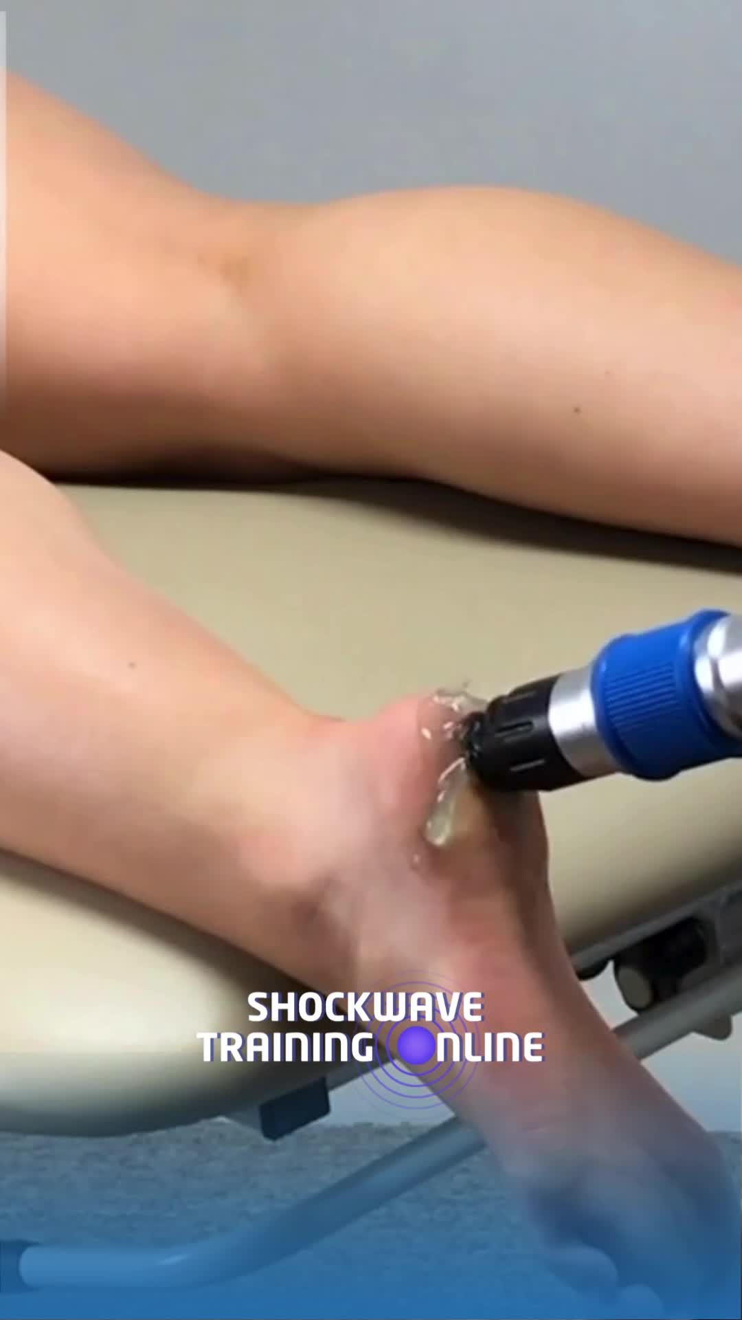 Learn the potential of shockwave therapy for treating Plantar Fasciitis! 🌟
Plantar Fasciitis is one of the most common causes of heel pain, and shockwave therapy has become a cornerstone in its management for healthcare professionals. Here's why:
✅ Reduces inflammation and promotes tissue healing
✅ Enhances blood flow to accelerate recovery
✅ Breaks down adhesions and calcifications
✅ Provides a non-invasive, evidence-based solution
This video demonstrates the precise application of shockwave therapy for Plantar Fasciitis, showcasing its practical and effective use in clinical practice. At https://buff.ly/3Dsu6Zh, we simplify shockwave training with step-by-step demonstrations, expert advice, and rehab integrations to enhance your clinical outcomes.
Ready to refine your skills? Join our online course today and deliver better results for your patients with confidence.
#ShockwaveTherapy #PlantarFasciitisTreatment #HealthcareTraining #ShockwaveForProfessionals #EvidenceBasedPractice #MusculoskeletalCare #NonInvasiveTherapy #SportsInjuryRehab #TissueHealing #AdvancedTherapies #PhysioEducation #RehabTechniques #FunctionalRecovery #InjuryManagement #ProfessionalDevelopment #ShockwaveSuccess #PainReliefInnovation #ActiveRecovery #PhysioTools #RehabTraining #HeelPainManagement #TherapySolutions #OnlinePhysioCourses #InnovativeCare #PlantarFasciitisCare #AdvancedRehab #PrecisionTherapy #HealthcareEducation #ShockwaveApplications #ClinicalExcellence
