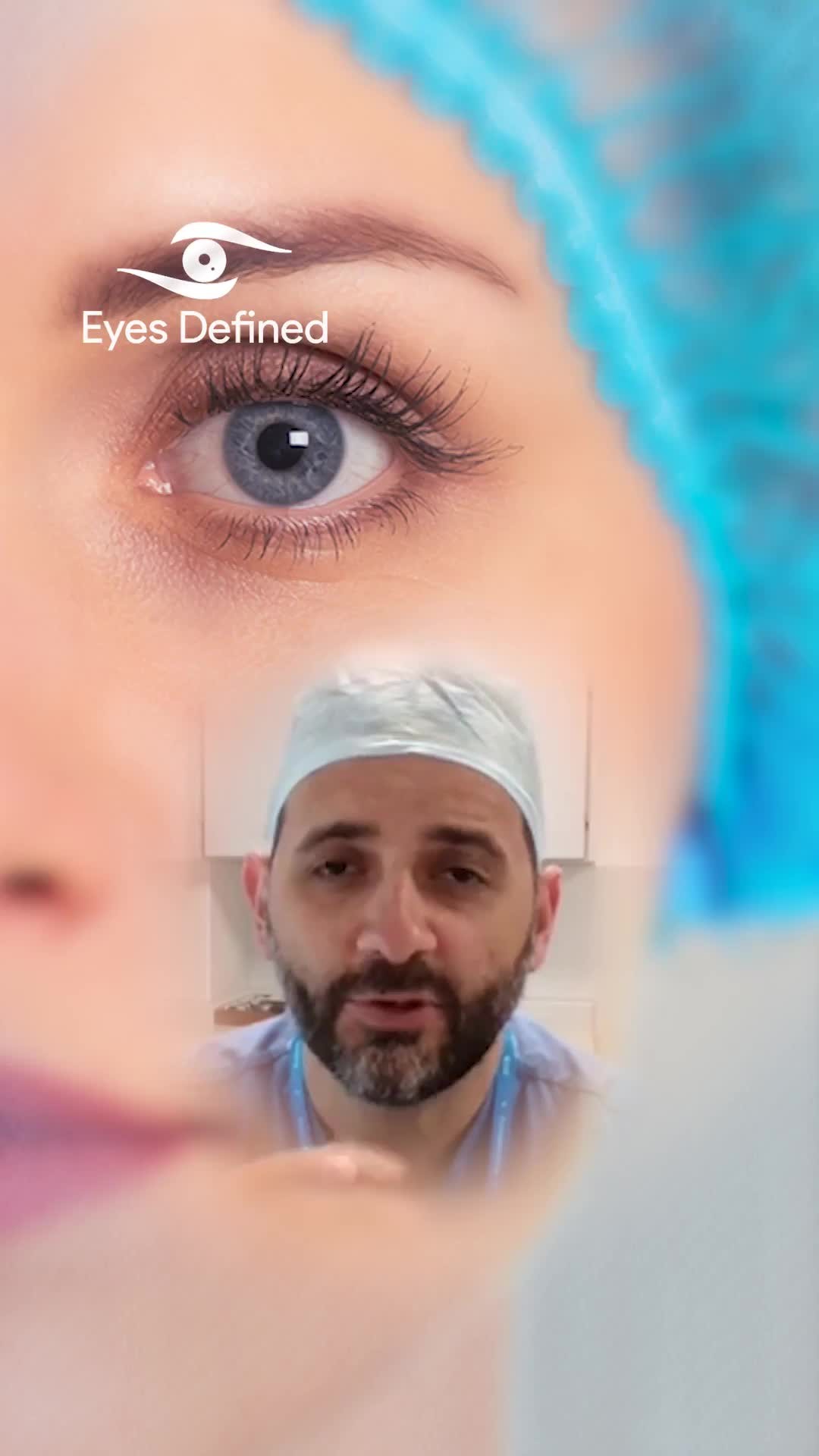 Thinking about lower eyelid blepharoplasty? 🧐 Sometimes, less is more. In this video, I explain when NOT to go ahead with surgery — and why it's crucial to choose the right solution for your eyes, not just the most popular one. 👁️✨ #TrustTheExpert
#OculoplasticSurgeon #LondonSurgeon #LowerBlepharoplasty #EyelidSurgery #UnderEyeBags #BlepharoplastyAdvice #CosmeticSurgeryLondon #EyelidHealth #FacialAesthetics #NaturalResults #SurgicalAwareness #KnowBeforeYouGo