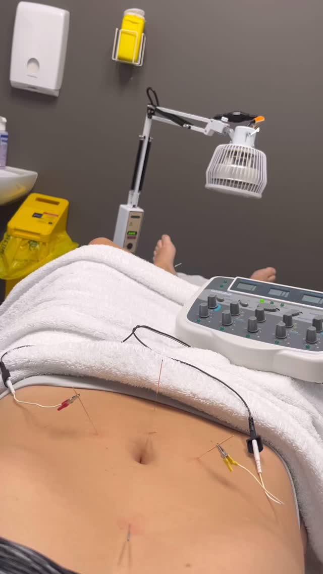 🍳 It’s easy to blame foods like eggs, tomatoes, gluten or dairy for acne, but these aren’t the root cause.
Yes, they can become reactive when your system is already under stress: chronic inflammation, nervous system dysregulation, poor blood sugar control, over-exercise, negative self-talk. All of this impacts your gut, hormones and detox pathways.
And while cutting foods out seems like the answer, for most people it doesn’t bring true relief because the root cause hasn’t been addressed.
Instead of over-restricting, most of my clients actually need to:
• Identify and correct microbiome imbalances through targeted gut testing
• Support digestion with enzymes, stomach acid, and anti-inflammatory strategies
• Open detox pathways and reduce internal heat
• Balance hormones and stabilise blood sugar
• Calm the nervous system
• Rebuild a healthy relationship with food
• And nourish their skin from within with more protein, fibre and essential fats
Yes, temporarily removing a confirmed trigger food can be helpful, but the goal is always to build resilience and restore confidence with food, not fear it.
👉If you’ve been cutting out food group after food group and still feel stuck, it’s time to dig deeper.
✔️DM me “clear skin” to explore a personalised, root-cause approach to healing you acne.
#gutskinconnection #acnehealing #acneguthealth #hormonalacne #acnefoodtriggers #naturopathicskin #acneanxiety #acneholistichealing #acnetips #skinnutrition #cosmeticacupuncture #skinfromwithin #internalhealing #nervoussystemhealing #clearacneskin