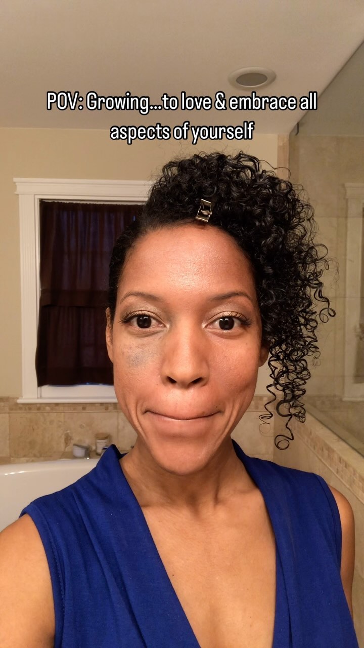 🥰💞
.
.
.
.
.
.
.
.
.
.
.
.
—“I am beautifully blemished”
#loving #all #aspects #of #me #birthmarkedbeauty #growth #lovingme #thegood #thebad #dothework #havepatience #visibledifference #itsabirthmark #nevus #beautifullyblemished