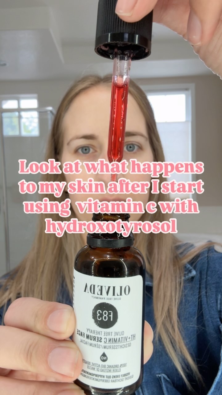 Say goodbye to acne scars + sun spots and hello to glowing skin! ✨
My complexion is brighter and more even thanks to the natural power of Vitamin C from the Camu Camu fruit. 🍊
This serum boosts collagen, reduces fine lines, and protects from free radicals without fillers—perfect for all skin types. 🙌🏻
Want glowing skin too? Comment ‘VIT C’ for my go-to serum and a personalized skin consult. Plus, learn how to score a FREE product! 🫒
.
.
.
.
.
#vitamincglow #cleanbeautyroutine #skincareessentials #hydratingserum #glowingskintips #acnescarcare #waterlessskincare #holisticbeauty