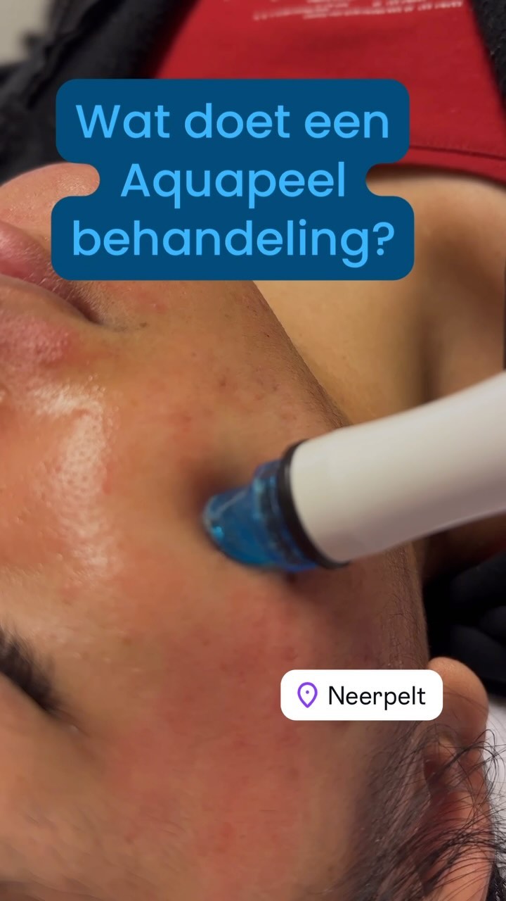 Een mini huidverzorging behandeling…
#overpelt #neerpelt #lommel #mesoskinbenelux
