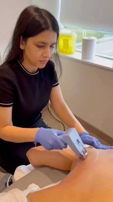 🌟Just another day at SKIN MD! 🌟 Today, we’re diving into the wonders of Morpheus8 Body for skin tightening on the back and arms. 💪🏻✨ Say goodbye to sagging skin and hello to a more toned appearance! #skintightening #morpheus8oakville #selfcare #beautygoals