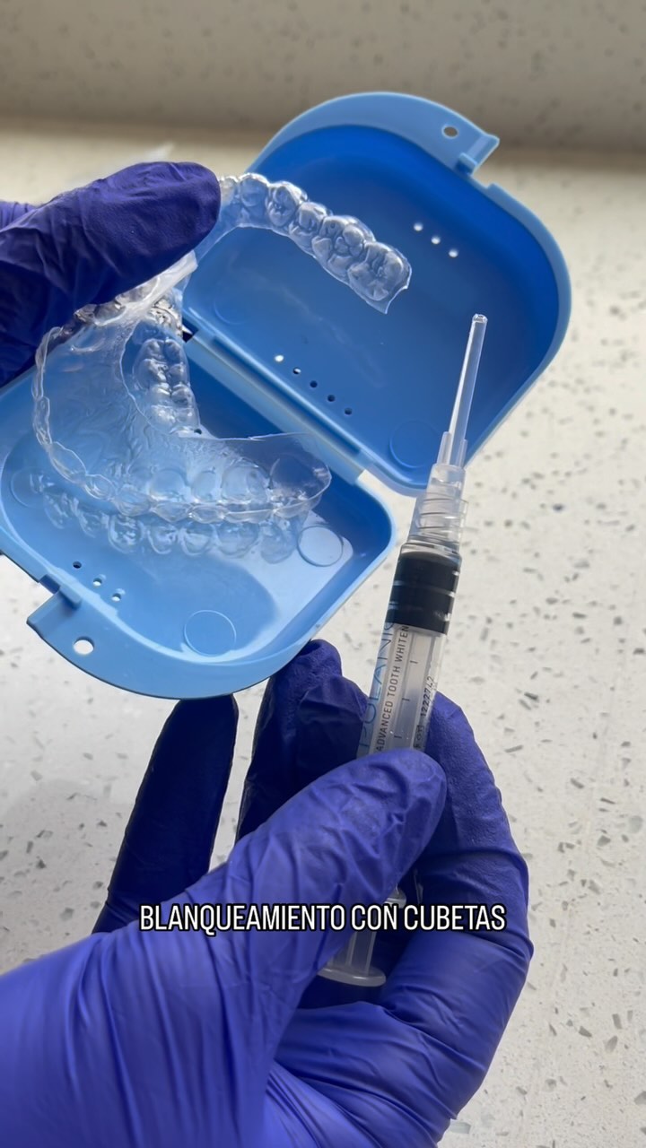 ¿Buscas tener una sonrisa más blanca? El blanqueamiento dental con cubetas puede ser la solución ideal para ti. 🦷✨
🔹 **Resultados visibles**
🔹 **Comodidad**: Realízalo desde la comodidad de tu hogar con nuestras cubetas personalizadas.
🔹 **Seguridad**: Este tratamiento es seguro y efectivo, supervisado por profesionales.
👩⚕️ **Consulta personalizada**: Agenda tu cita hoy y descubre cómo podemos ayudarte a conseguir la sonrisa que siempre has querido. Recuerda que cada paciente es diferente y no está indicado para tod@s.
Disponibles para más información escribiéndonos por mensaje.
¡No esperes más! 🌟
#BlanqueamientoDental #SonrisaPerfecta #CuidaTuSonrisa #DentalCare #EstéticaDental