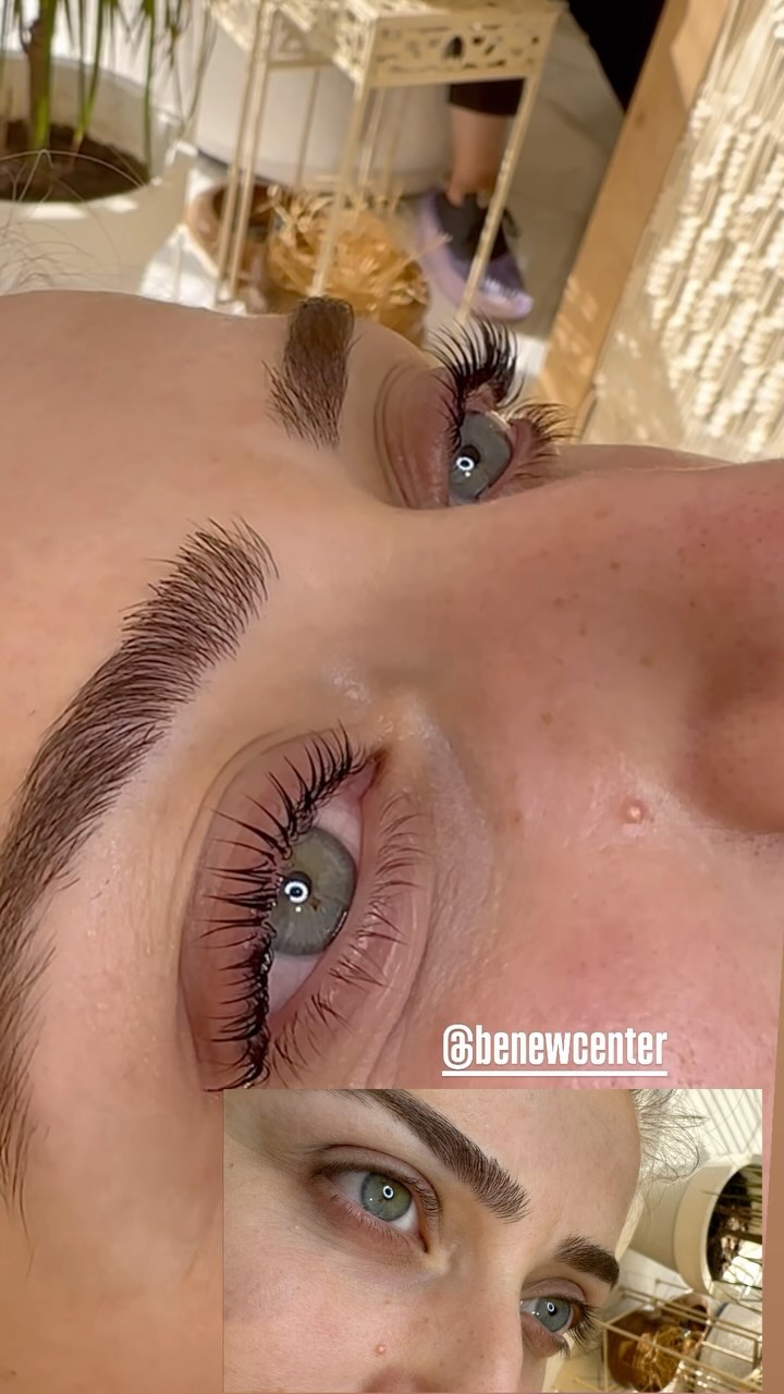 Tüm uygulamalarımızda İthal marka ürünlerle işlem yapılmaktadır.Uygulamada kullandığımız ürün inlie markası olup menşei İtalya dır.Kirpik Lifting işlemi ile bakışlarınıza anlam katın .
#lifting #kirpiklifting #kirpikuzatma #kirpikbotox