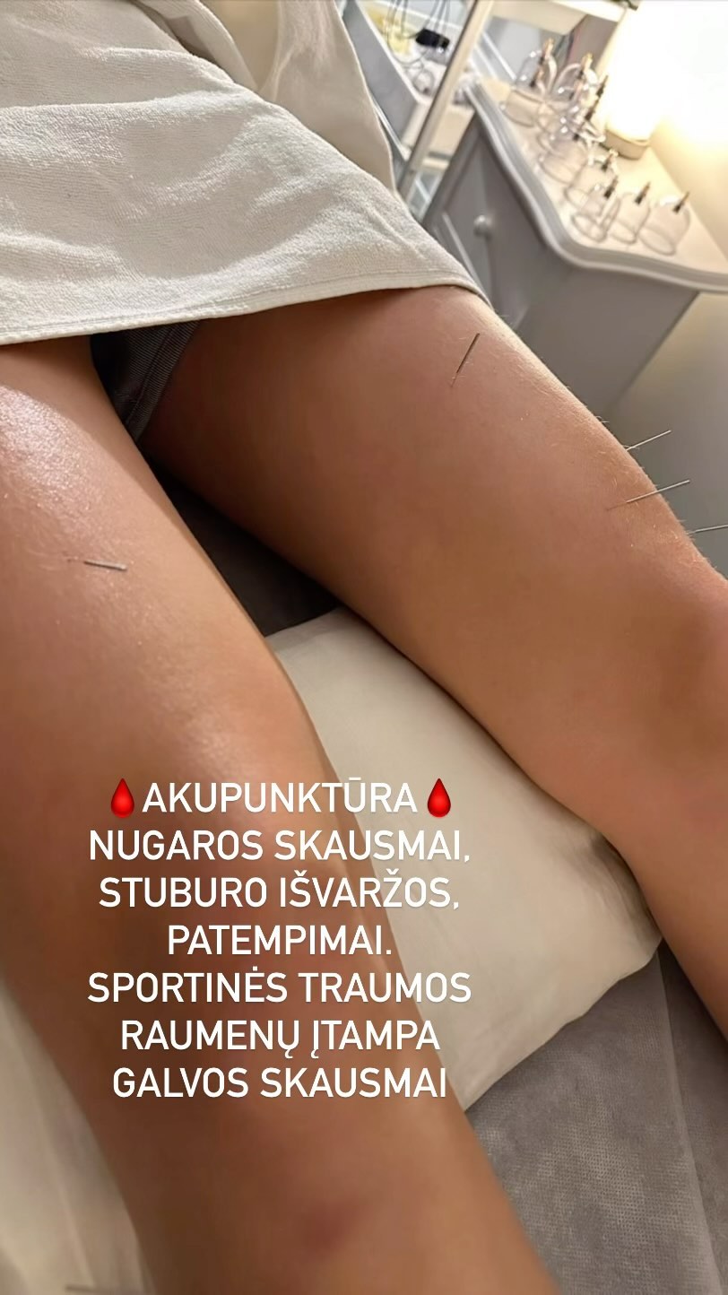 Holistika- alternatyvių terapijų taikymas gydant sportines bei kasdienias traumas🌻