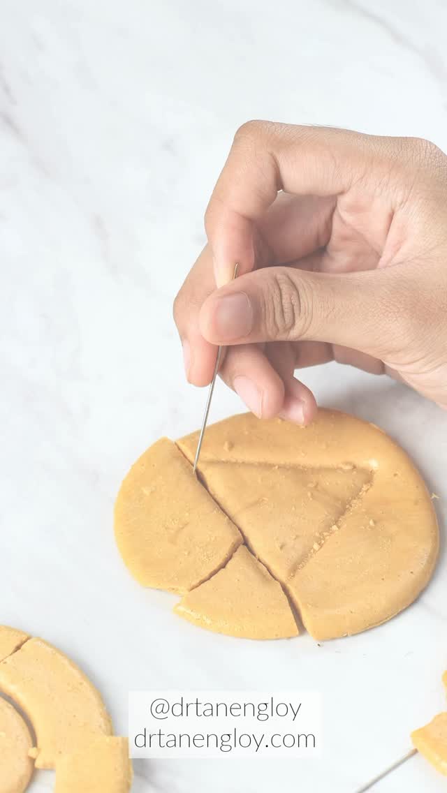 🍬 Pregnancy Dalgona Challenge!
Folic acid? Calcium? DHA? Iron?
Should you take ALL of them?
怀孕不是随便“补一补”。你需要的补充品,应该根据你的身体和孕期阶段来决定。
陈英礼医生提醒:
✅ 第一孕期最重要的是叶酸(folic acid)
✅ 后期可能需要补铁、DHA 或钙
✅ 不需要一次过补一堆!
🎯 最好的保健方案,是为你量身定做的。
🎥 Watch Episode 2 now — Pregnancy Squid Game continues.
#SquidGameChallenge #PregnancyIsNotAGame #DalgonaChallenge #PregnancyReels #MumToBe#PregnantAndConfused #BumpLife #PregnancyTips #SquidGamePregnancy #BabyOnBoard