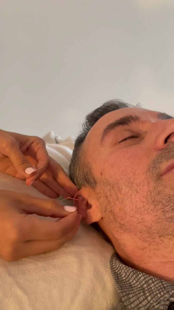 Did you know there’s over 200 acupuncture points on each ear??
When I was in acupuncture school years ago, a senior practitioner gave me some amazing advice. He told me that no matter what I did, to “always treat the ear”.
After nearly 8 years, I can confirm that he was he right.
Just like in foot reflexology, you can treat the whole body and all of the organ systems by using associated reflex points on the ear.
Auricular therapy, also known as ear reflexology, is an incredibly powerful microsystem for so many conditions - muscle and joint pain, high blood pressure, insomnia, weight loss, toothaches and addictions just to name a few.
Here I’m treating the Ear Apex, Shenmen, sacrum and hip girdle points for low back pain and reducing inflammation as an add-on to a full acupuncture session.
For info and questions just reach out :) Would love to hear from you.
Here to support your best health ❤️
Love,
Teressa @joyfulheartacuwellness
#auriculartherapy #riflessologiaauricolare #agopuntura #earreflexology #quitsmokingnaturally #naturalpainrelief #holistichealing #guarigioneolistica #medicinacinese