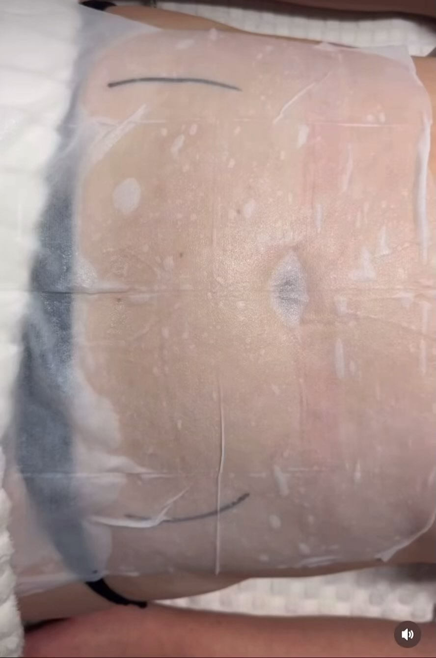 The NEW CoolSlimming Ultimate 360ยฐ machine has brand new upgraded technology with 13 Medical Grade Covered Silicone Grip Applicators for every area at every angle.
The extra large CURVE Max Applicator for Upper and Lower Abdomen covers 300% more of the treatment area than previous Models! 3 x More area covered means 3 x better the results will be! ๐
Contact us for more information ๐ฒ