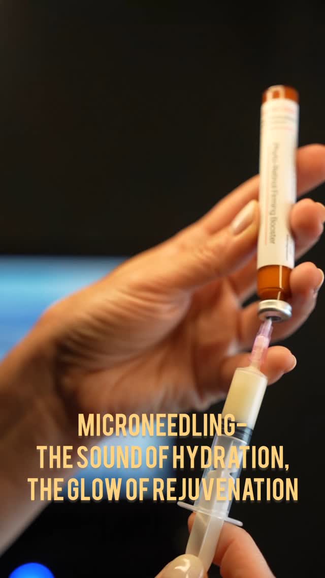 ✨ Great for:
✔️ Fine lines & wrinkles
✔️ Acne scars
✔️ Pore size
✔️ Skin tightening & glow
This powerful treatment uses tiny, controlled micro-injuries to stimulate your skin’s natural healing process, boosting collagen and improving texture, tone, and elasticity.
Don’t be scared — it’s safe, gentle, and we always use numbing cream to keep you comfortable.
We also use professional-grade serums in tightly sealed ampoules — not exposed to oxygen — and draw them into a syringe through a sterile rubber cap right before your treatment. Fresh, clean, and deeply effective.
The results? Fresh, radiant skin you’ll love! 💆♀️💖
#Microneedling #GlowingSkin #SkinRejuvenation #CollagenBoost #HealthySkin #LNOBeauty #HydrationBoost #SterileAndSafe #ProfessionalSkincare #MicroneedlingDenver #SelfCareGlow#lno_boutique
Let me know if you’d like a shorter caption for the video overlay or any visuals to go with it!
Tools
ChatGPT can make mistakes. Check i