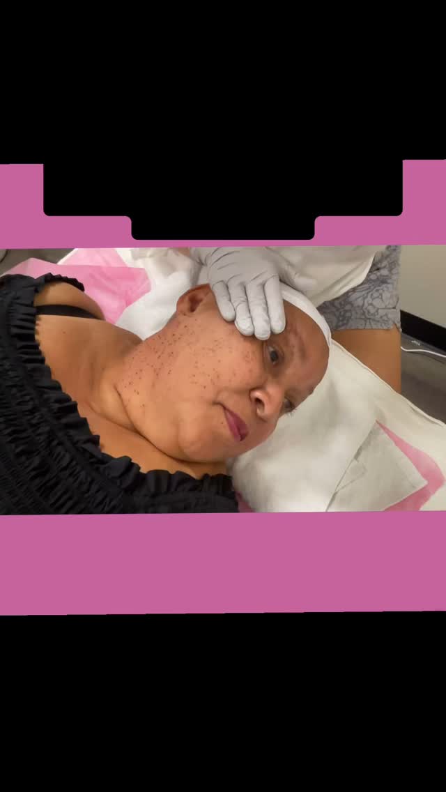 #capricebeautybar #theskingames2024 #age #tampabay #sarasotaflorida #medspa #skin #sarasota #dpn #skintags #venicflorida #stpeyersburgfl #lakewoodranchflorida #