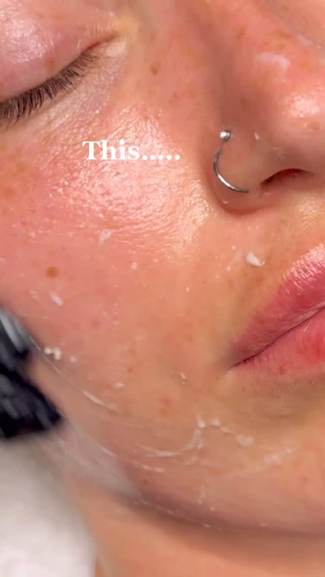 Healthy, radiant skin isn’t just about what you apply…….
it’s about what you remove. 🙌🏻🙌🏻
Exfoliation is the key to unlocking smoother texture, clearer pores, and improved product absorption.
Just make sure it is the correct exfoliation for your skin type 🫶
Skincare consultations and treatments available
⬇️
📍Birchington and Barham
#skincare #facial #exfoliation