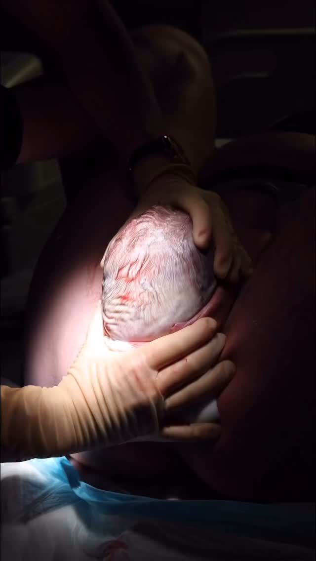 🎥: @nz_birthstories
•
Birthing your way—in your power—isn’t about control. It’s about sovereignty. ✨
It’s about knowing you have a voice. That your intuition matters. That how you feel during birth isn’t a side note—it’s the story.
When you birth in your power, you carry that strength with you into motherhood. You begin this next chapter rooted, confident, and connected to your inner wisdom. 🌿🕯️
Because how you’re treated in birth, how you feel in birth… it matters. You deserve to be seen, heard, and honored every step of the way. 💫
𝐀𝐥𝐰𝐚𝐲𝐬 𝐫𝐞𝐦𝐞𝐦𝐛𝐞𝐫: 𝐁𝐢𝐫𝐭𝐡 𝐦𝐚𝐭𝐭𝐞𝐫𝐬. 𝐒𝐨 𝐝𝐨 𝐲𝐨𝐮. 💖, @doula.heather.taylor
#BirthInPower #YourBirthYourWay #SacredBirth #ConsciousPregnancy #EmpoweredMotherhood #TrustYourBody #PhysiologicalBirth #DoulaHeatherTaylor #BirthMatters #WildWomanWisdom #HolisticBirth #WitchyMama #BirthAsRiteOfPassage #InformedBirth